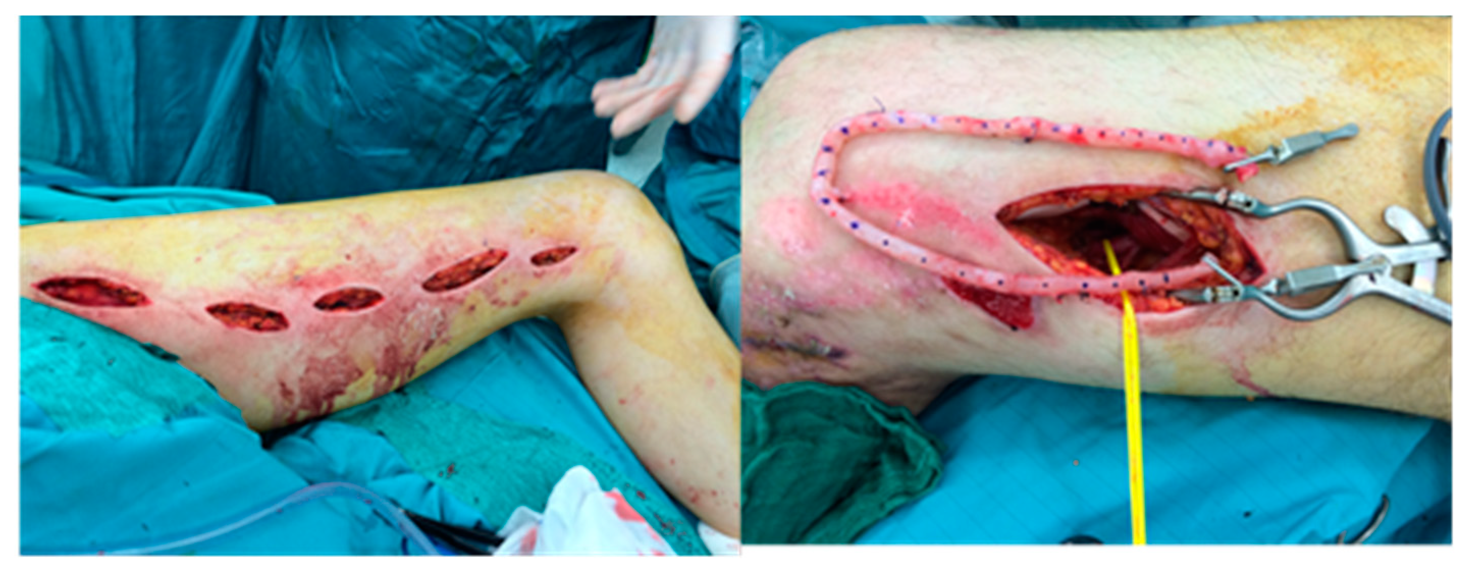 Medicina 56 00632 g010