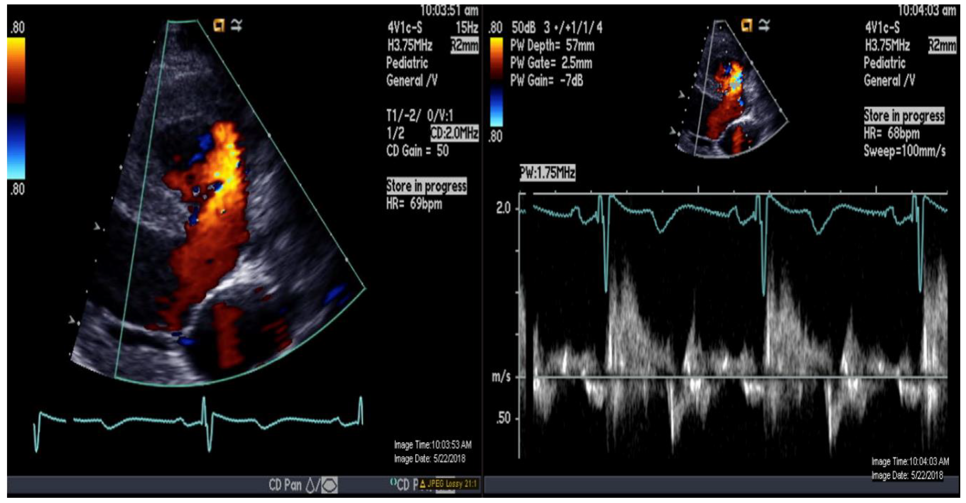 Medicina 56 00636 g002 Medicina 56 00636 g002