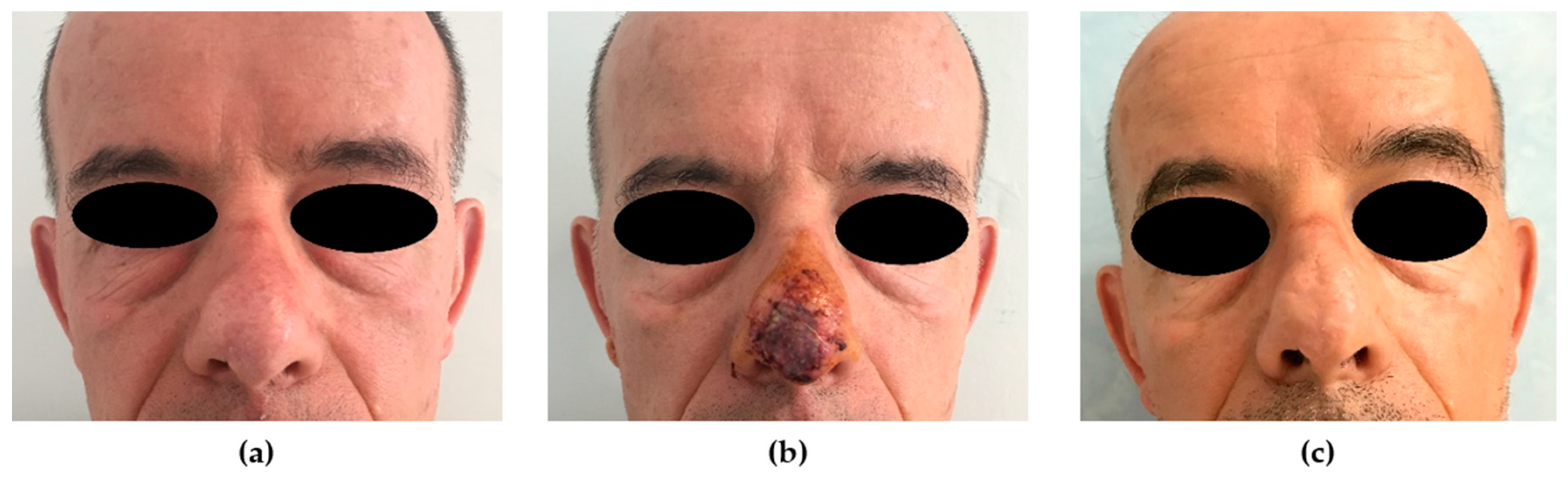 Medicina 56 00639 g002