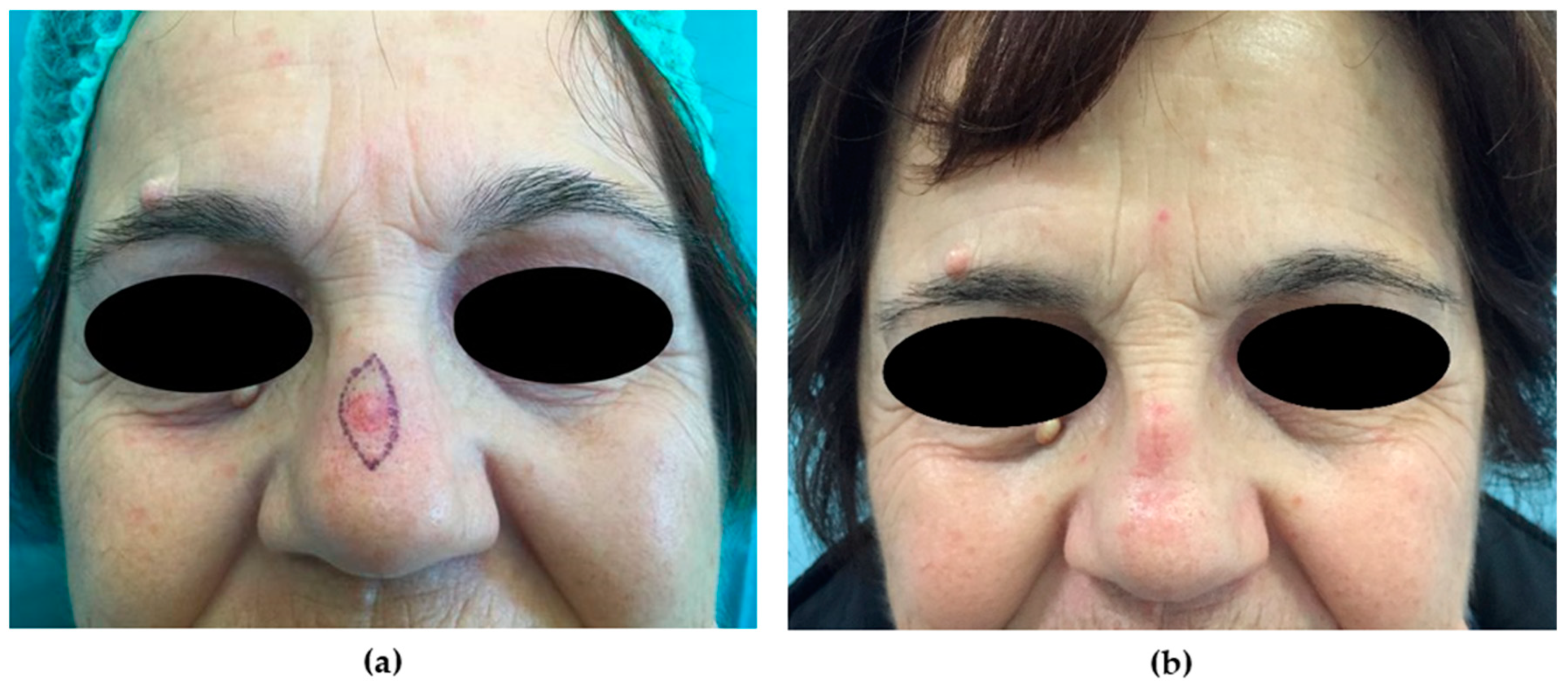 Medicina 56 00639 g003