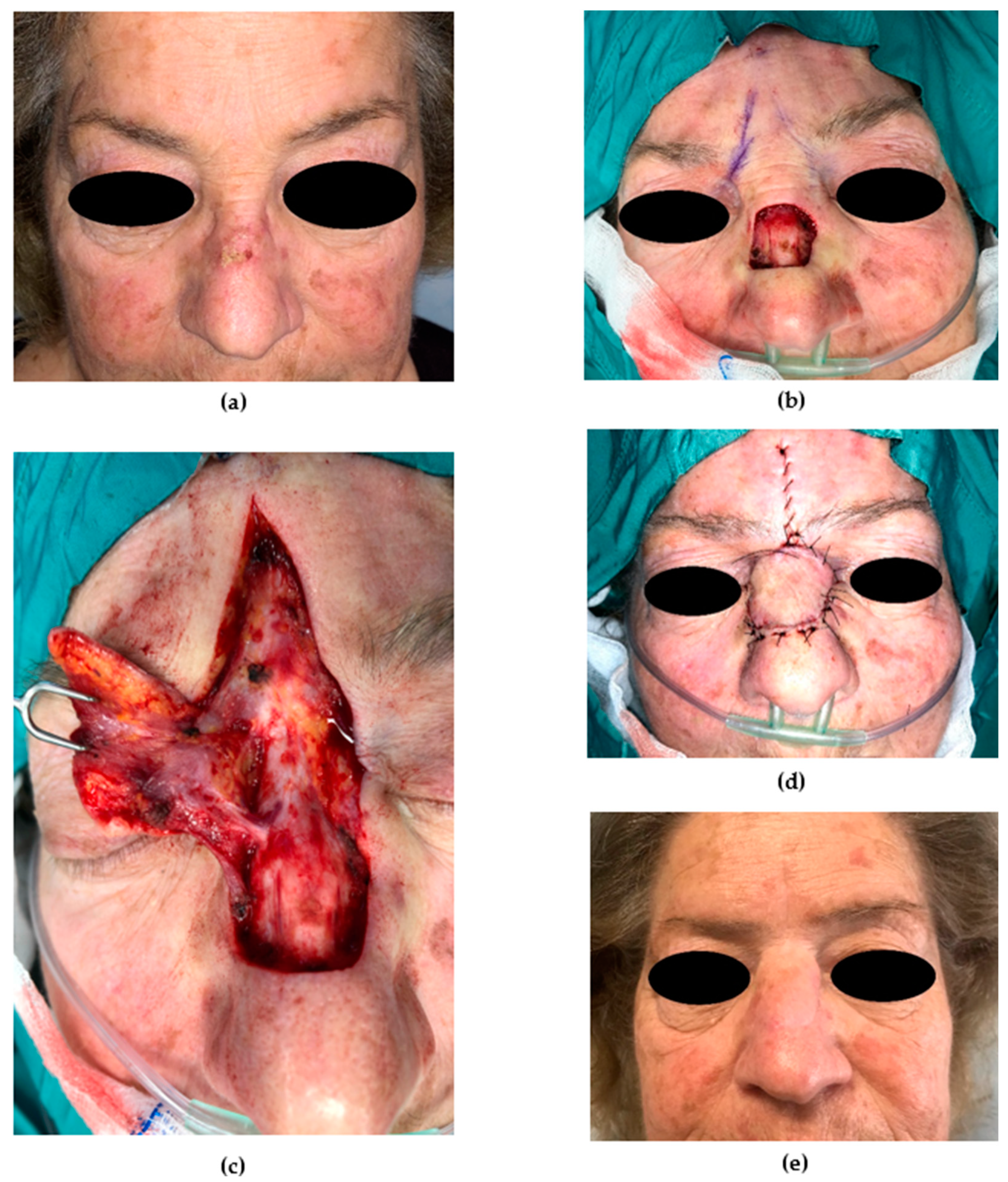 Medicina 56 00639 g007