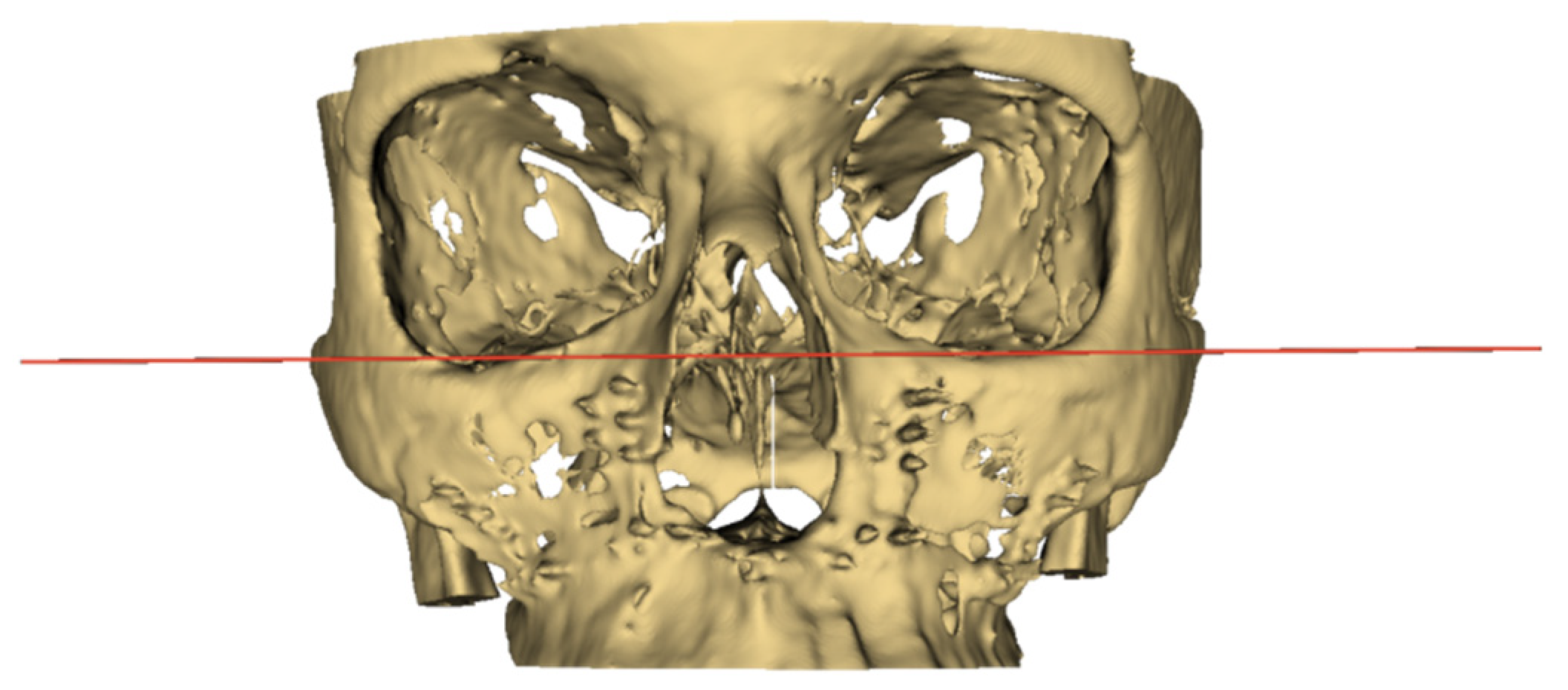 Medicina 56 00672 g003