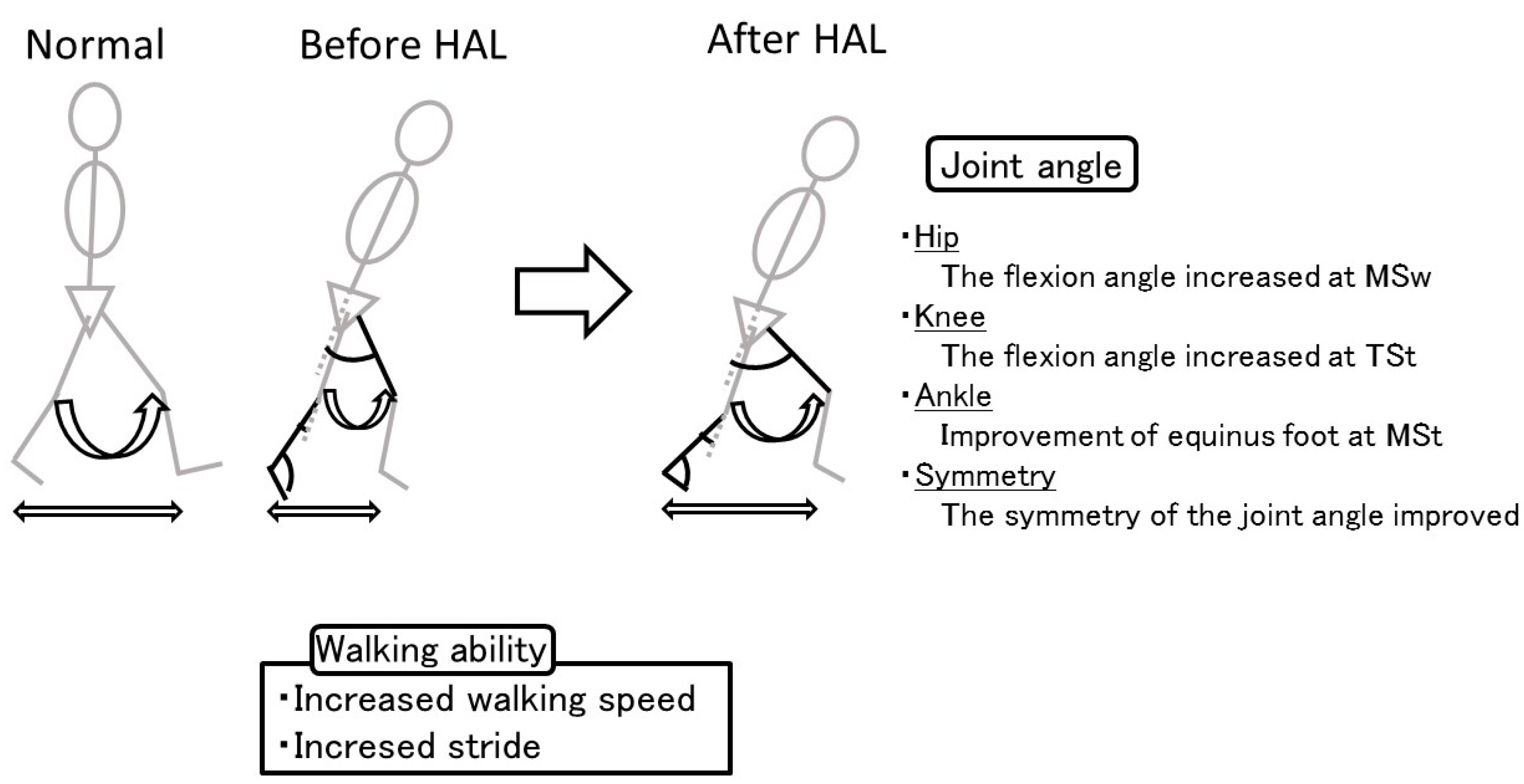 Medicina Free FullText Effect of the Hybrid Assistive Limb on the