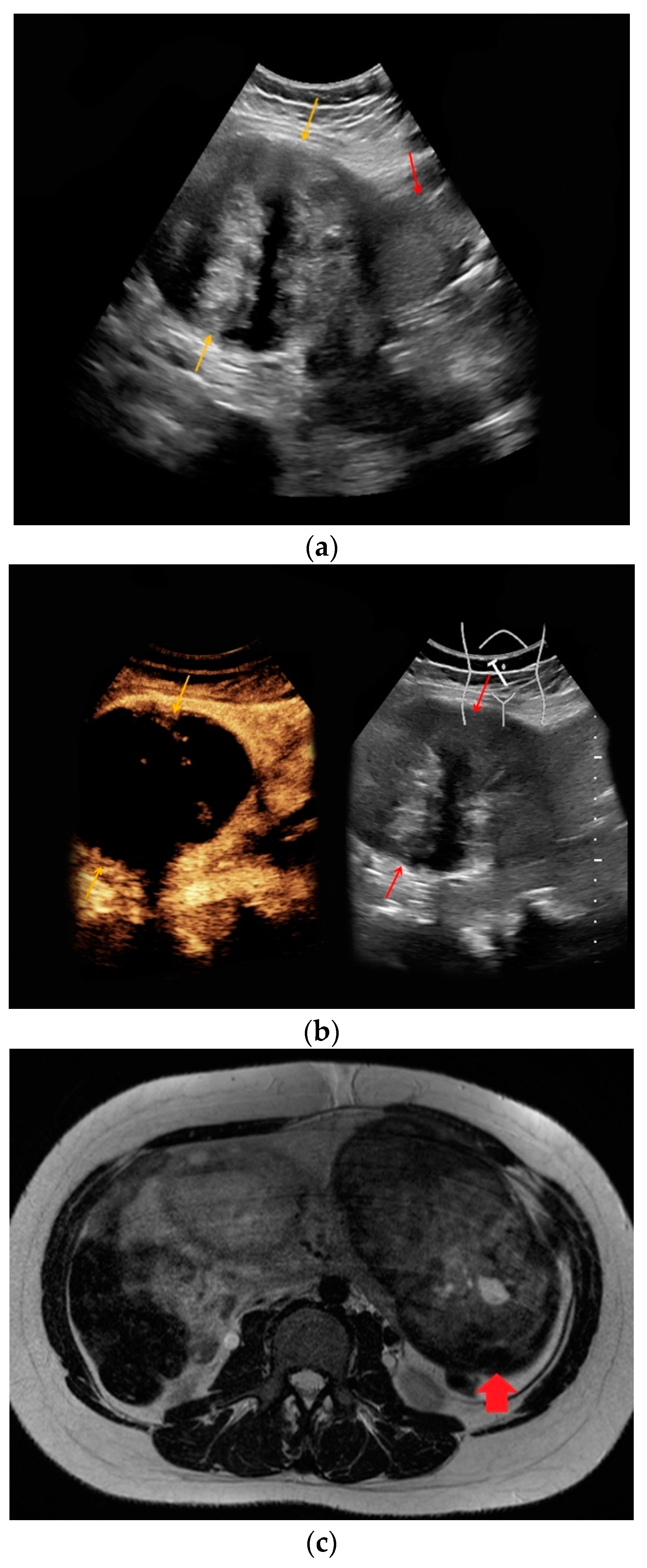 Medicina 56 00675 g002
