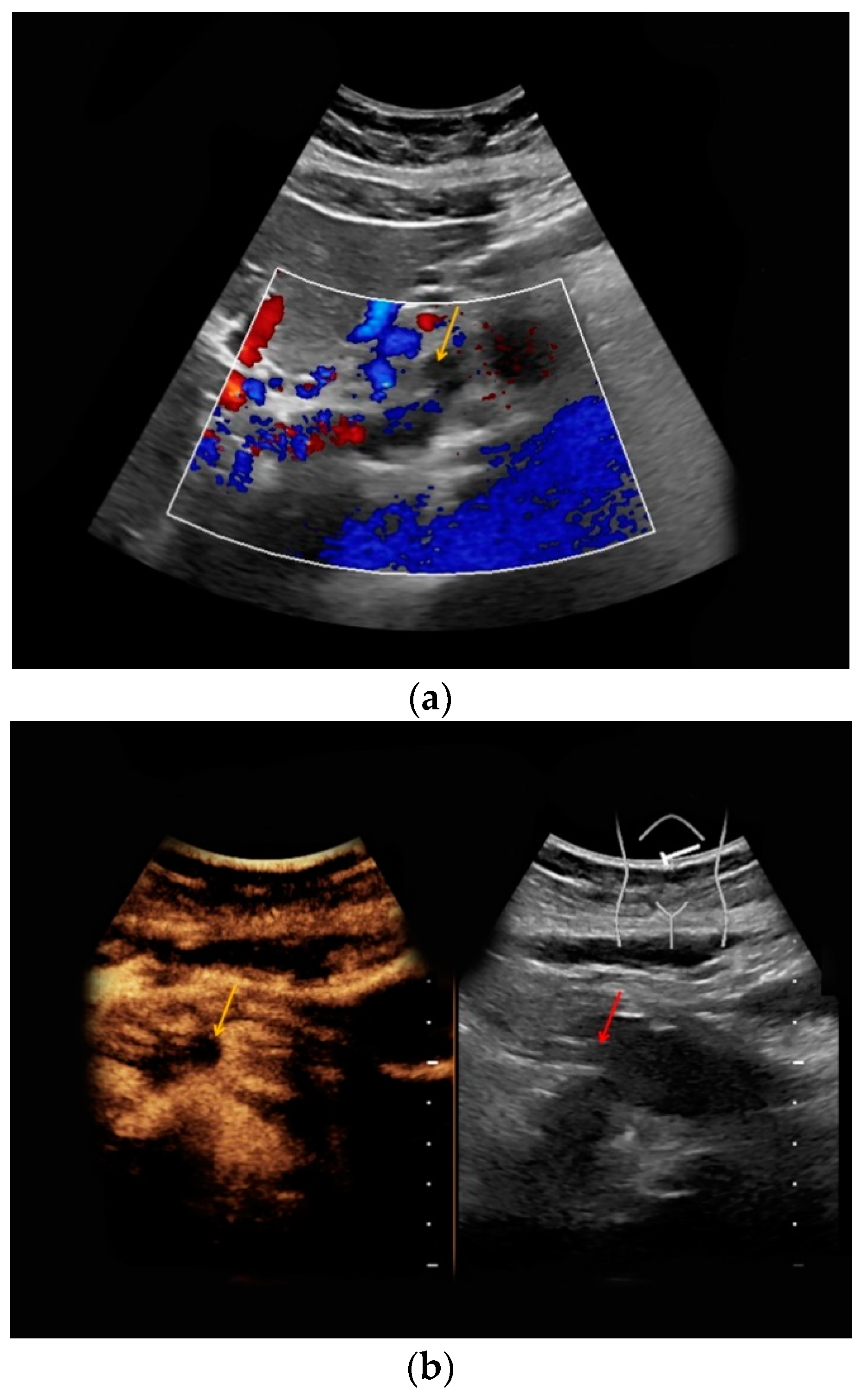 Medicina 56 00675 g004