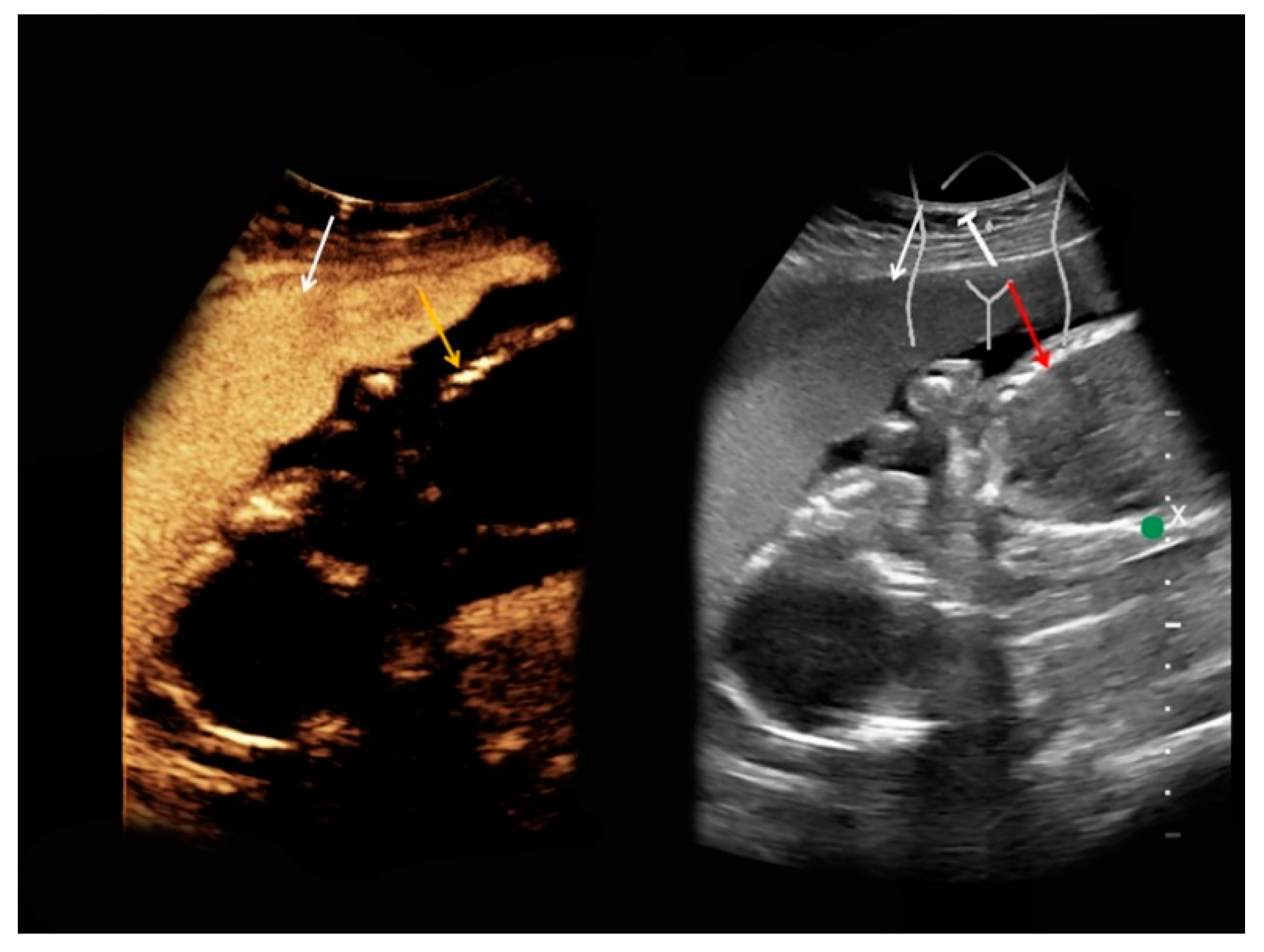 Medicina 56 00675 g005
