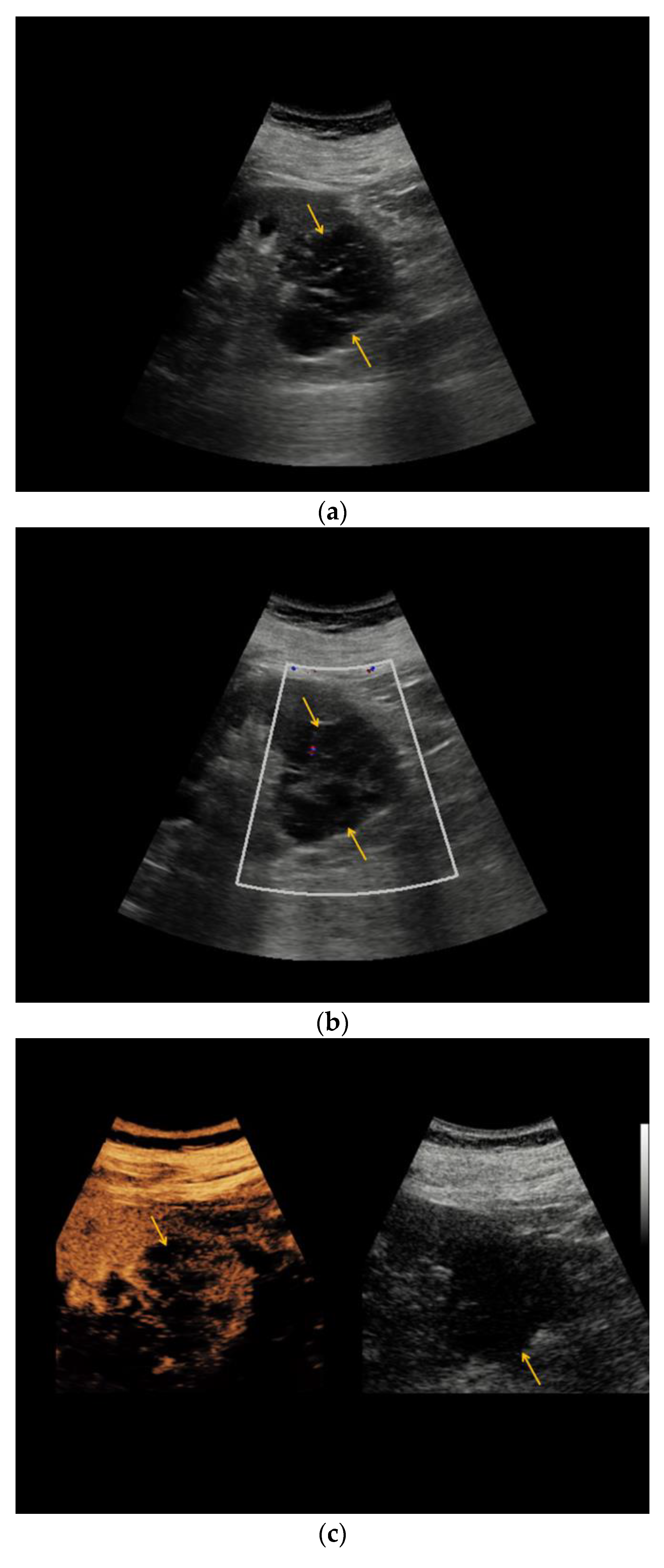 Medicina 56 00692 g002a Medicina 56 00692 g002a