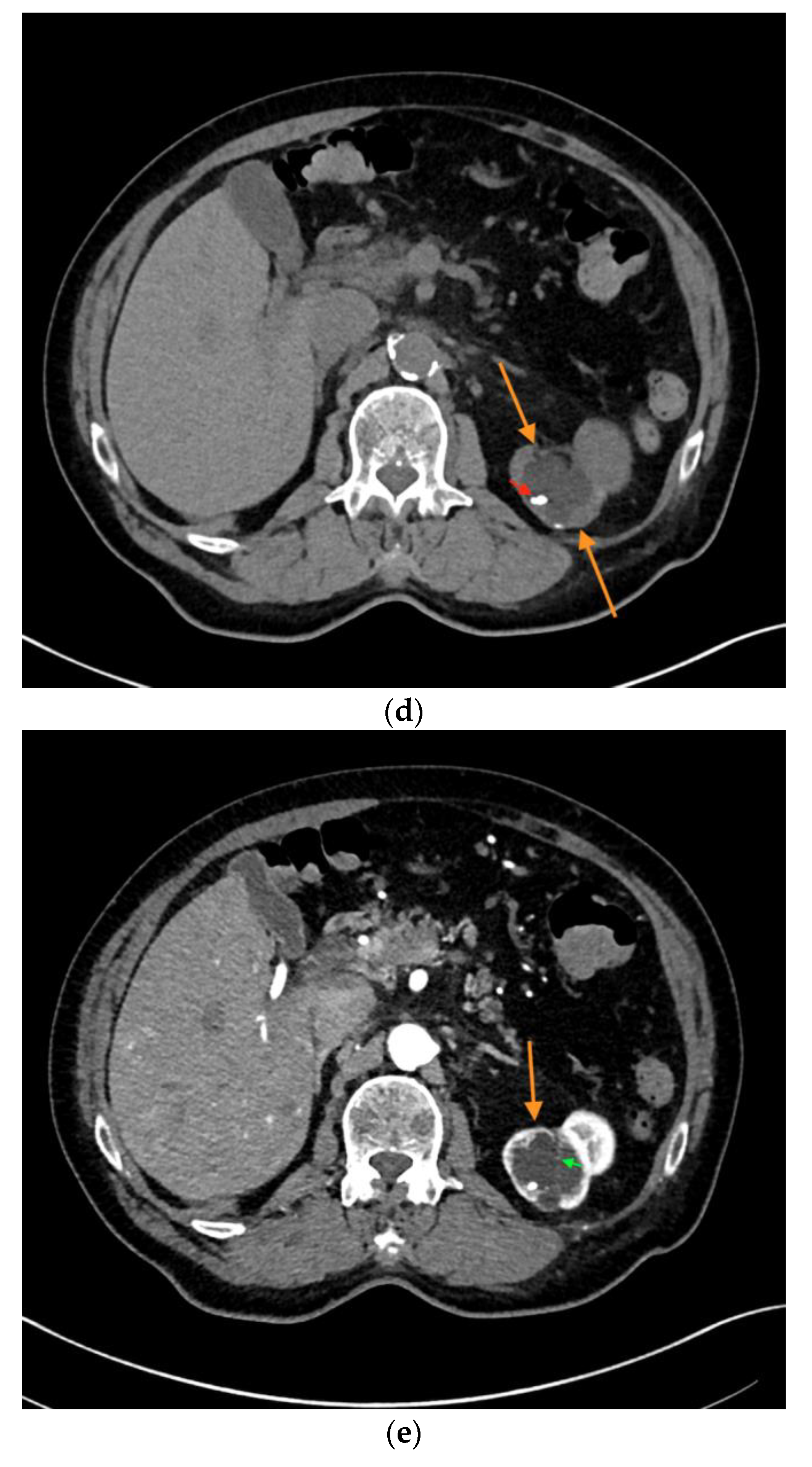 Medicina 56 00692 g002b Medicina 56 00692 g002b