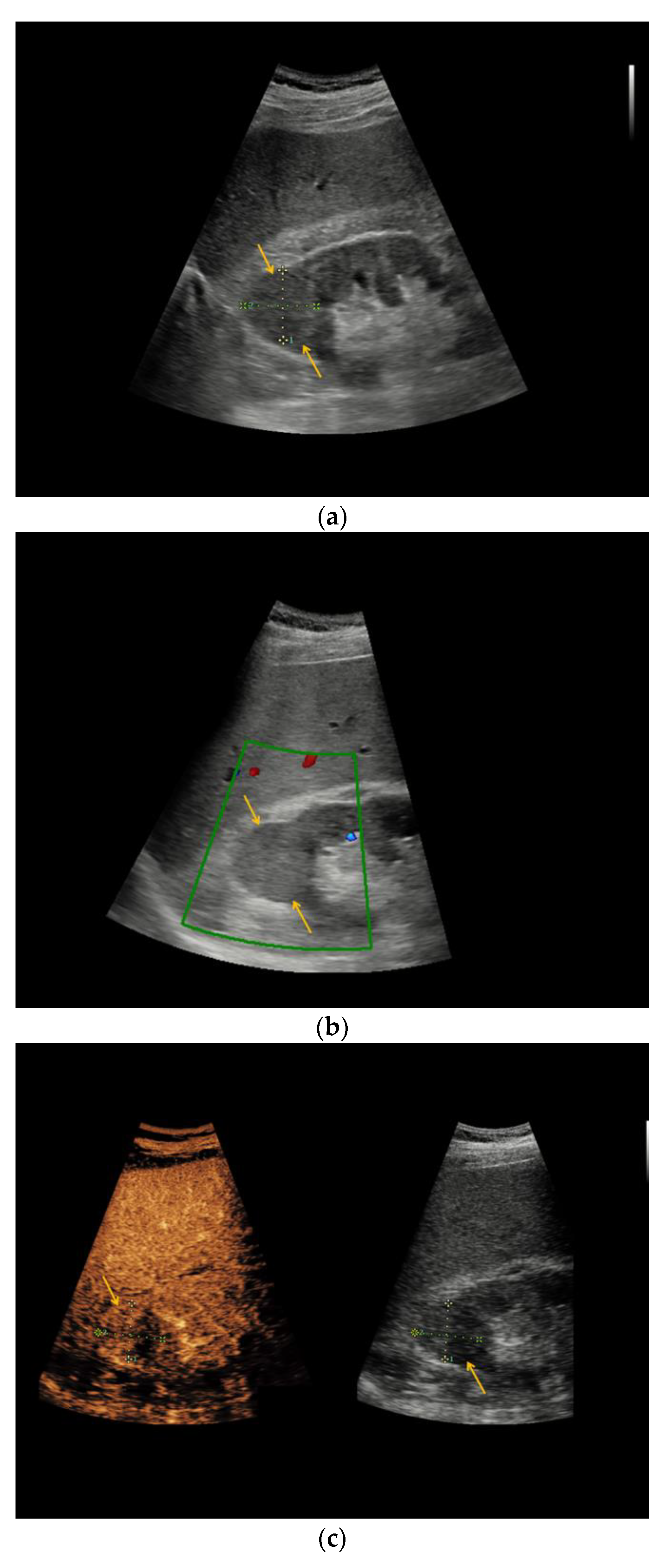 Medicina 56 00692 g003a Medicina 56 00692 g003a