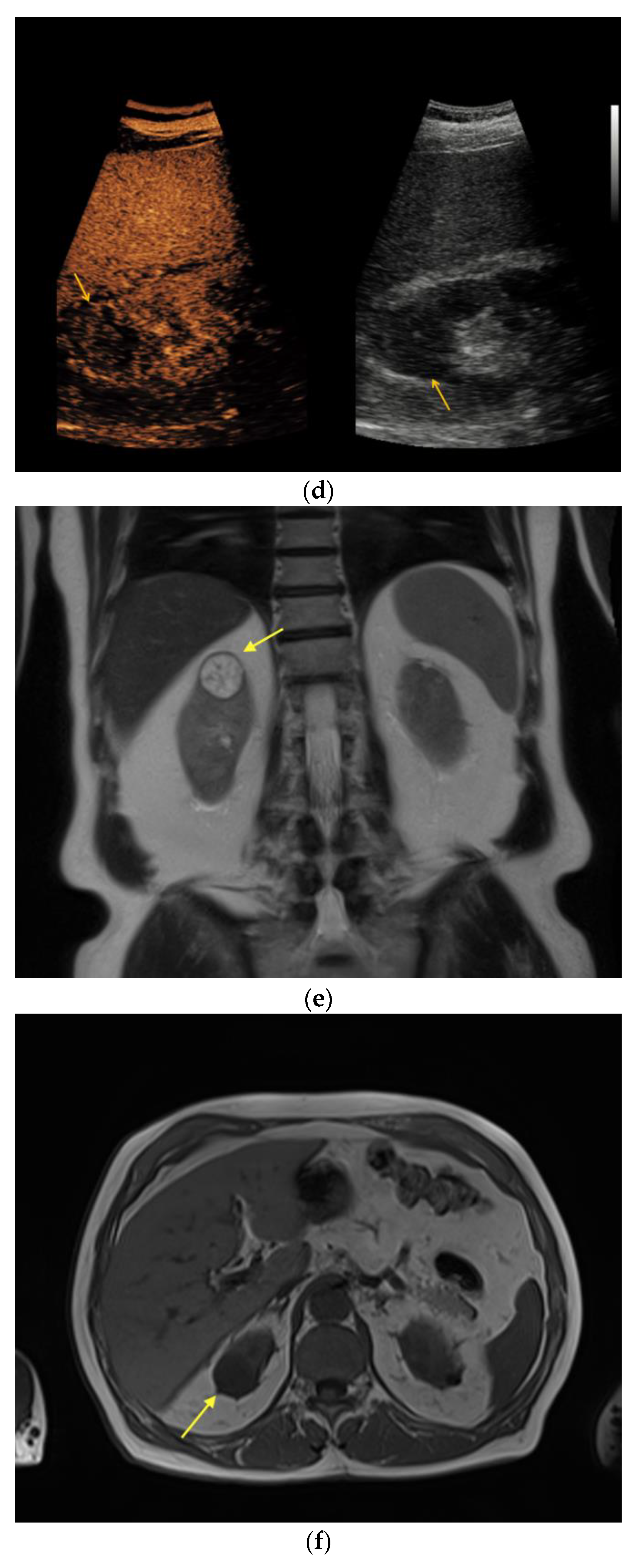 Medicina 56 00692 g003b Medicina 56 00692 g003b