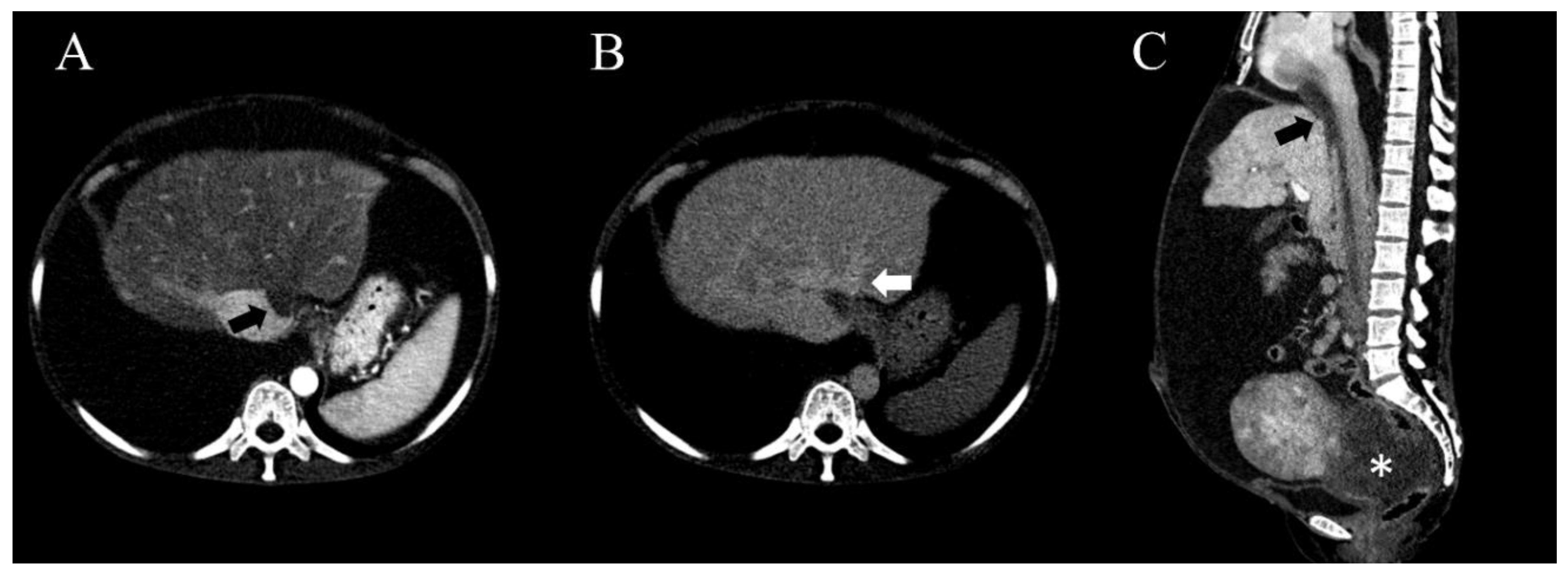 Medicina 56 00696 g002 Medicina 56 00696 g002