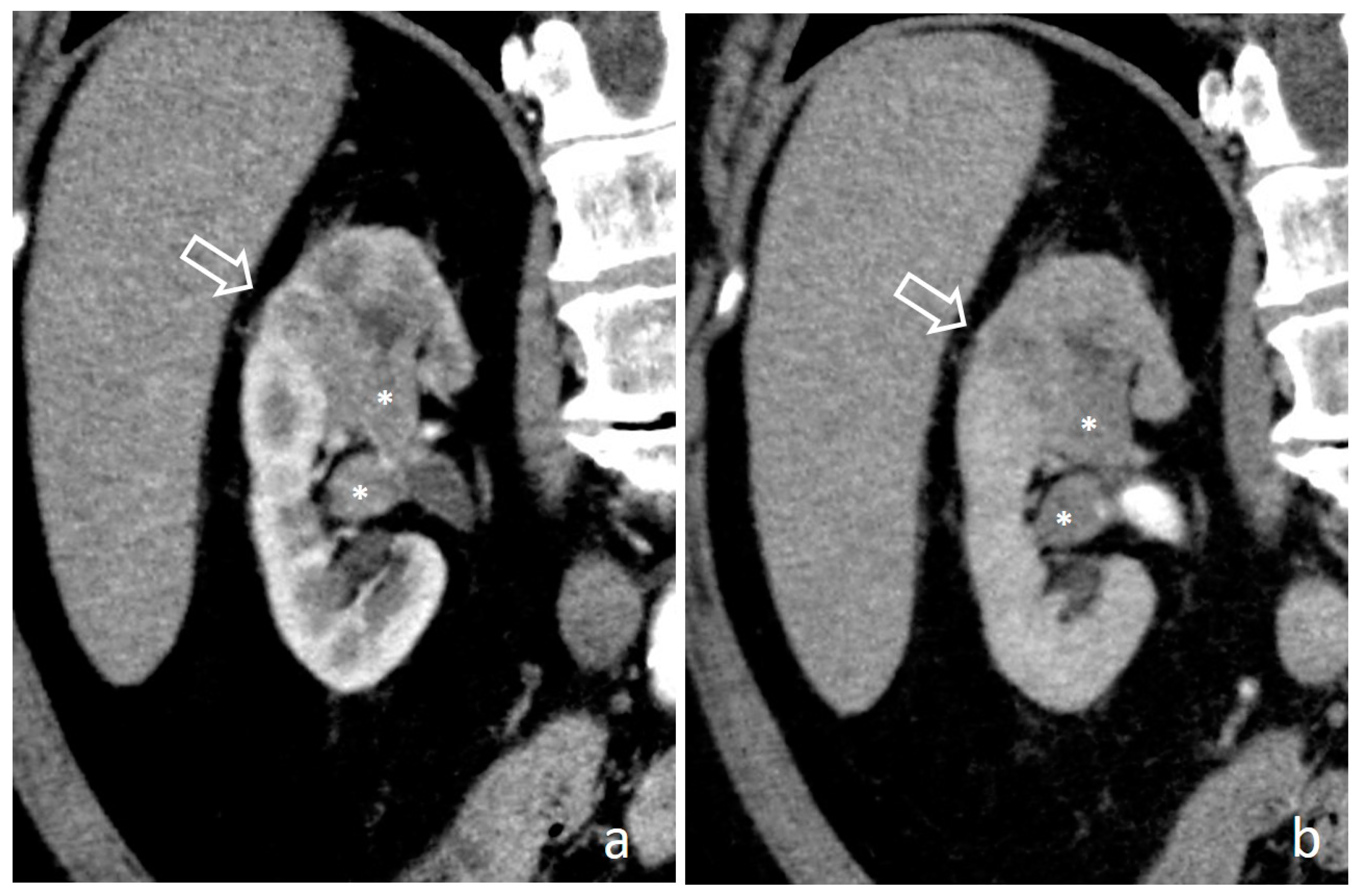 Medicina 56 00705 g007