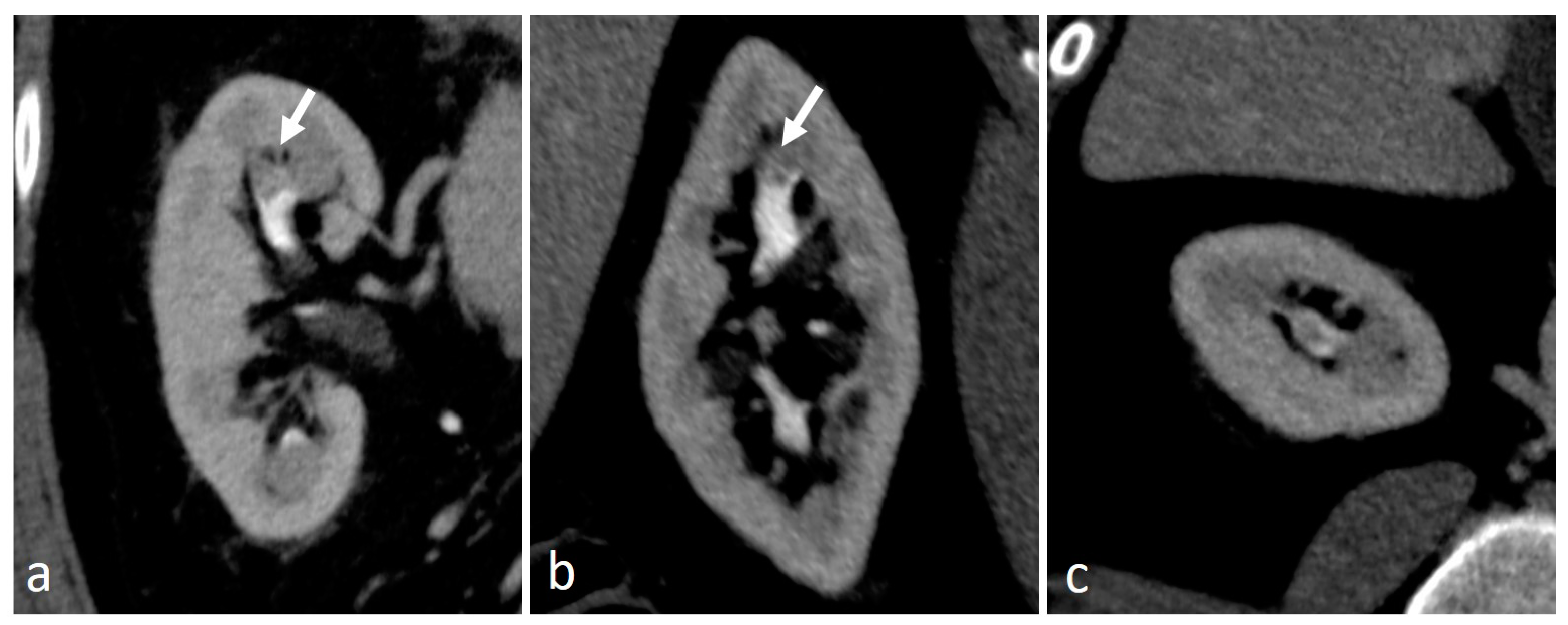 Medicina 56 00705 g008