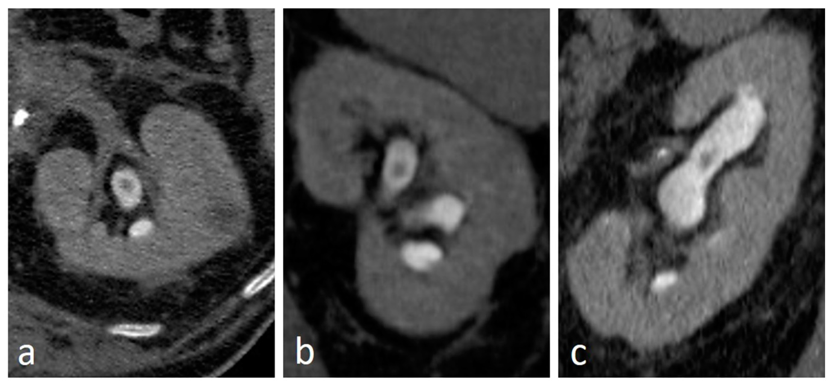 Medicina 56 00705 g009