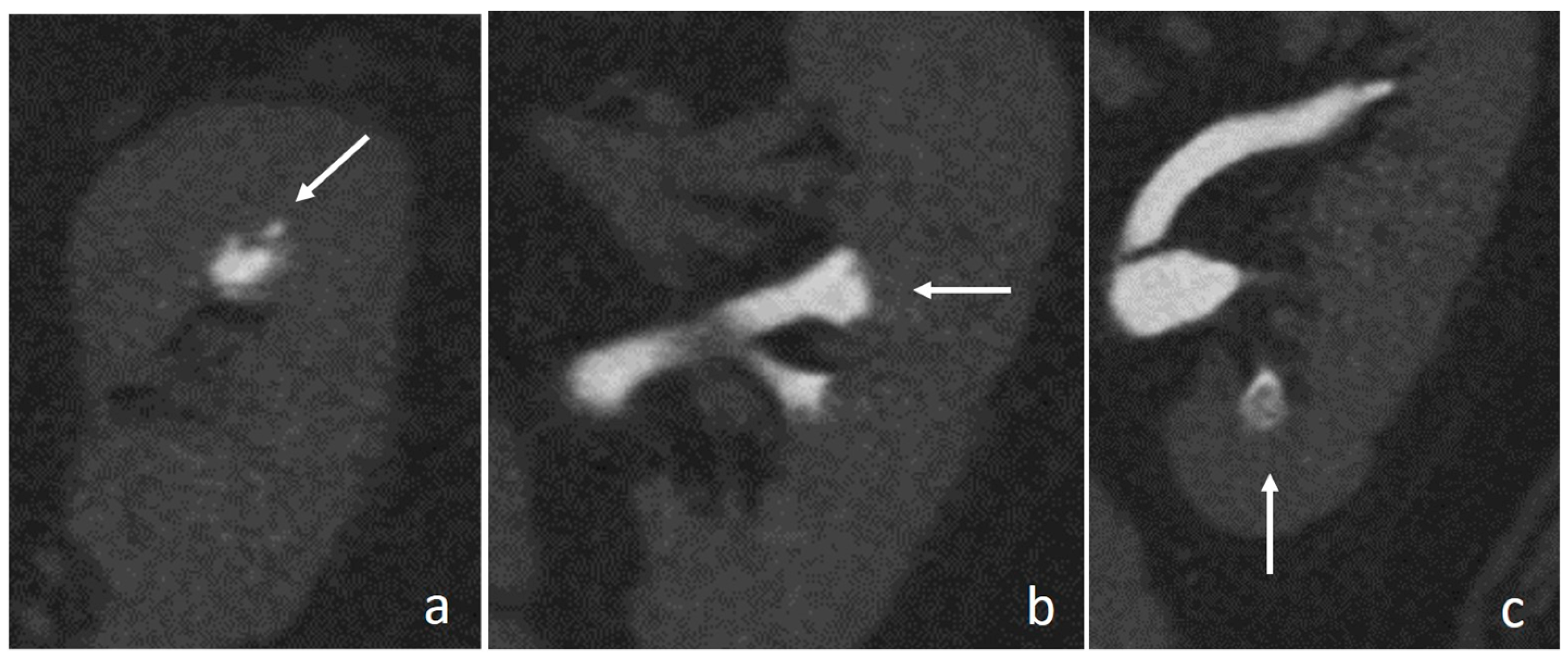 Medicina 56 00705 g011
