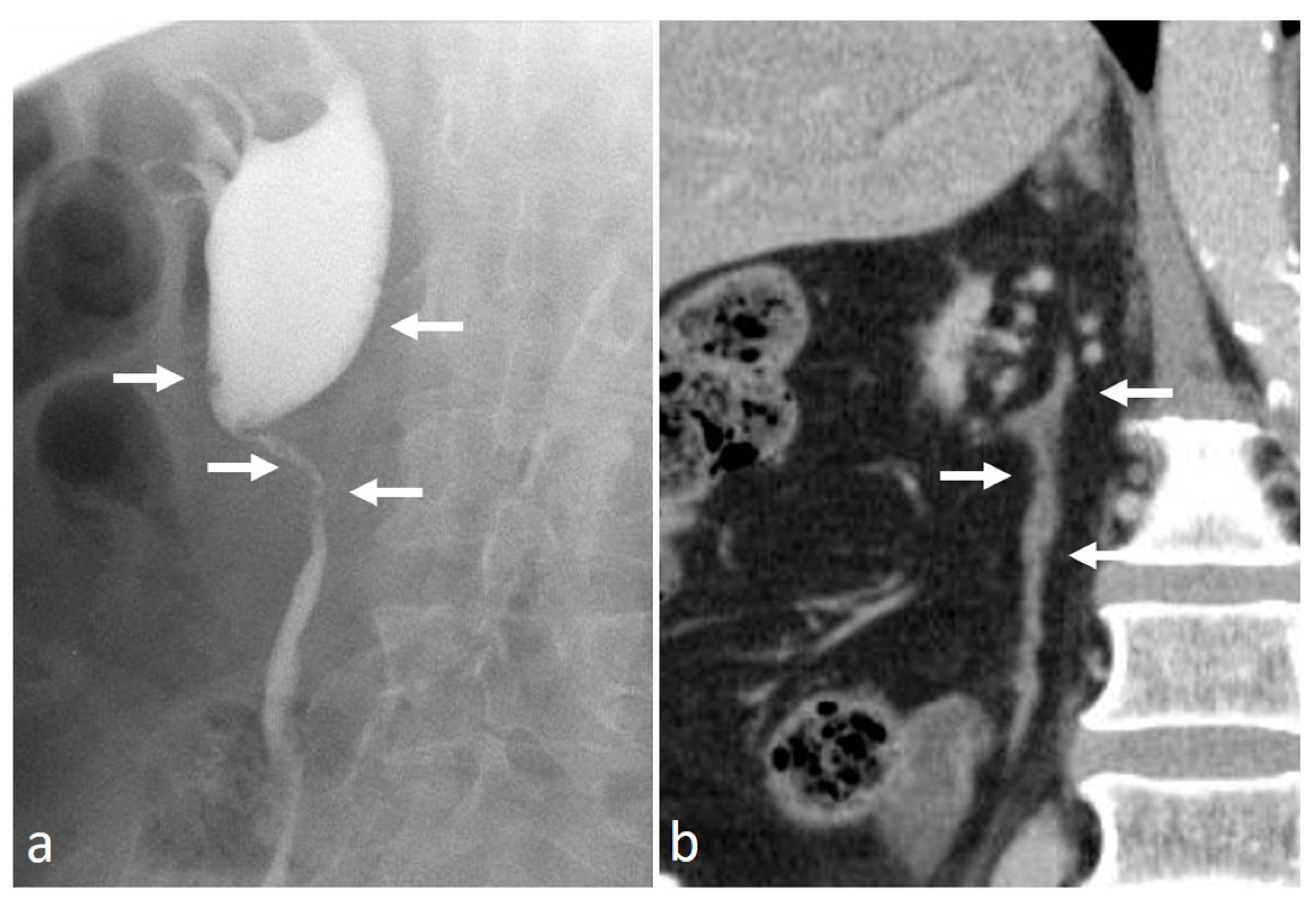 Medicina 56 00705 g015