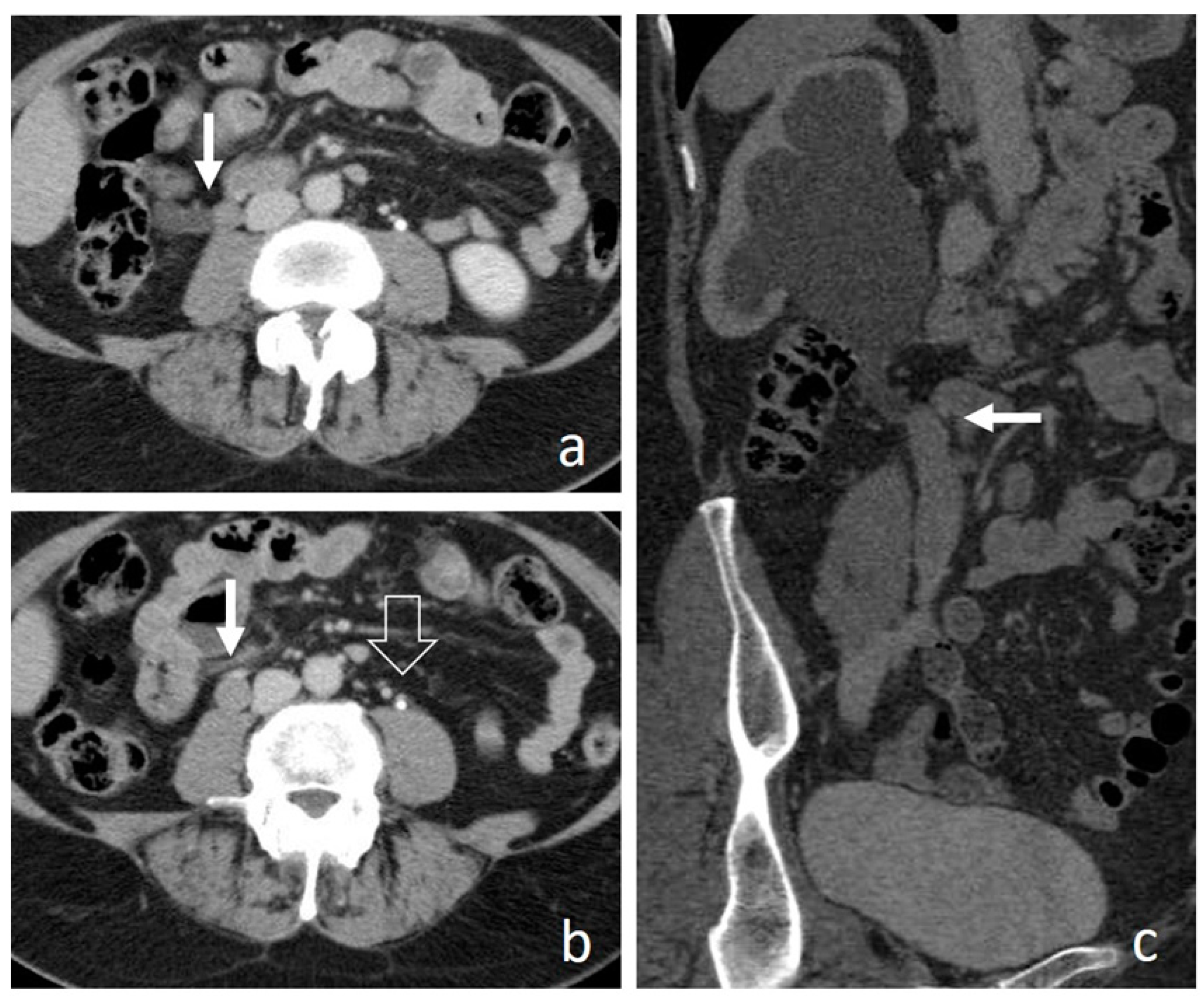 Medicina 56 00705 g017