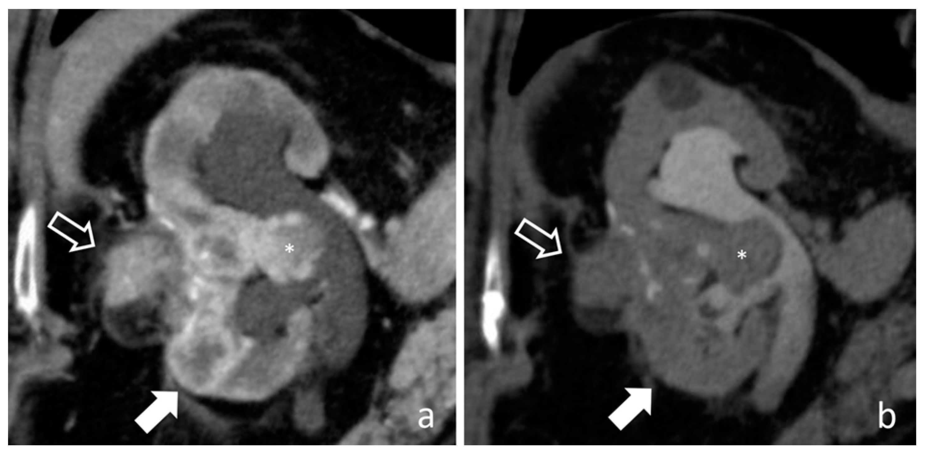 Medicina 56 00705 g018