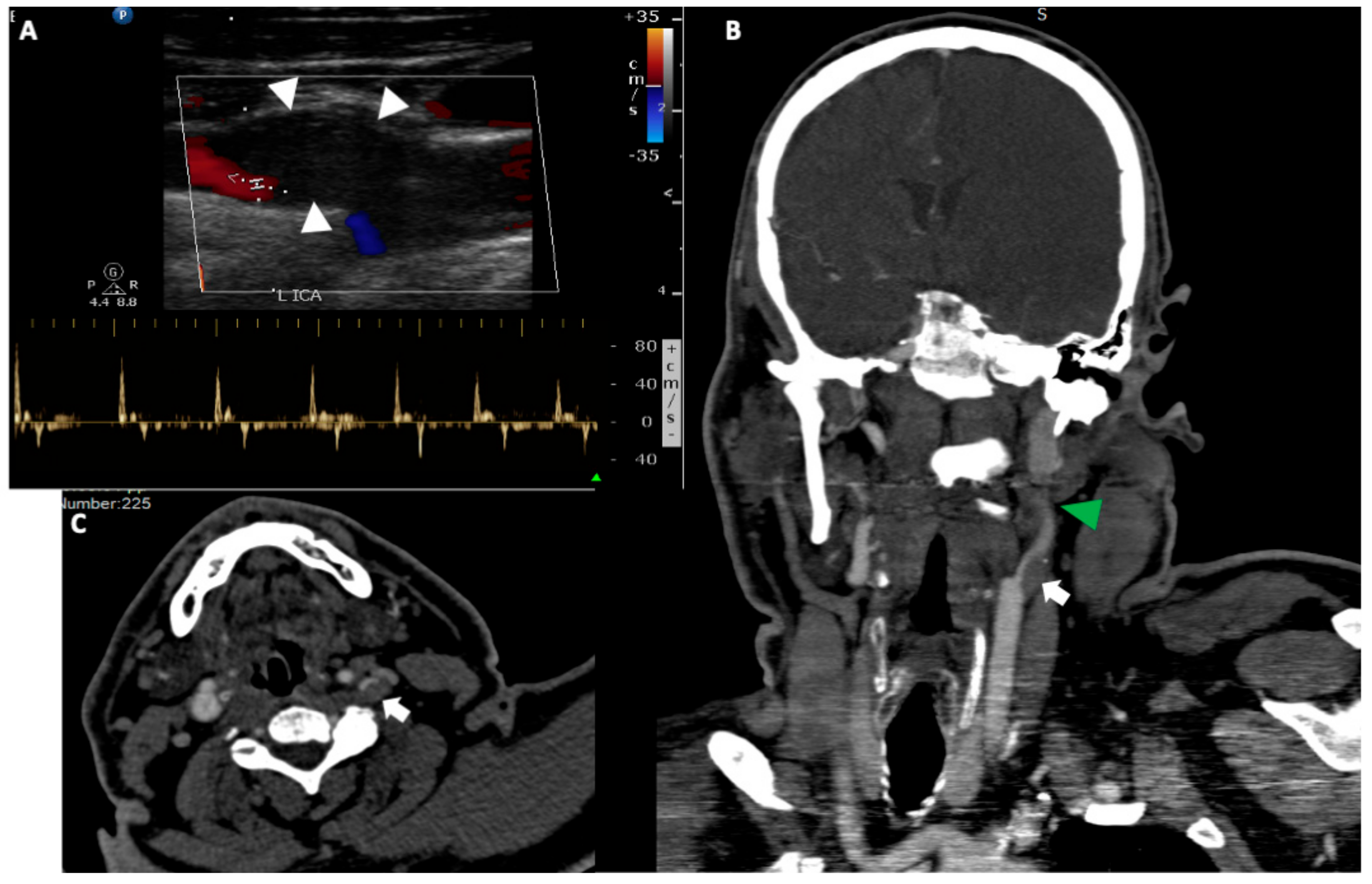 Medicina 56 00711 g002