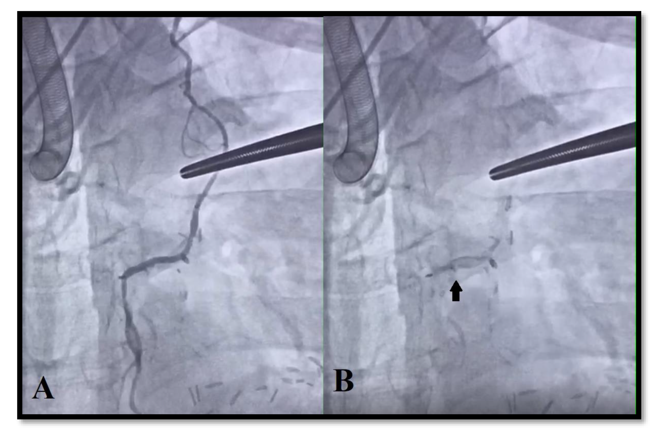 Medicina 56 00714 g006