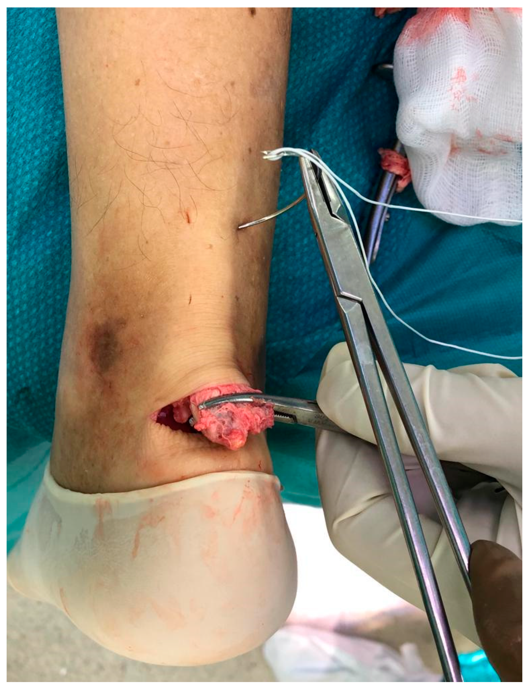 Medicina 56 00715 g002