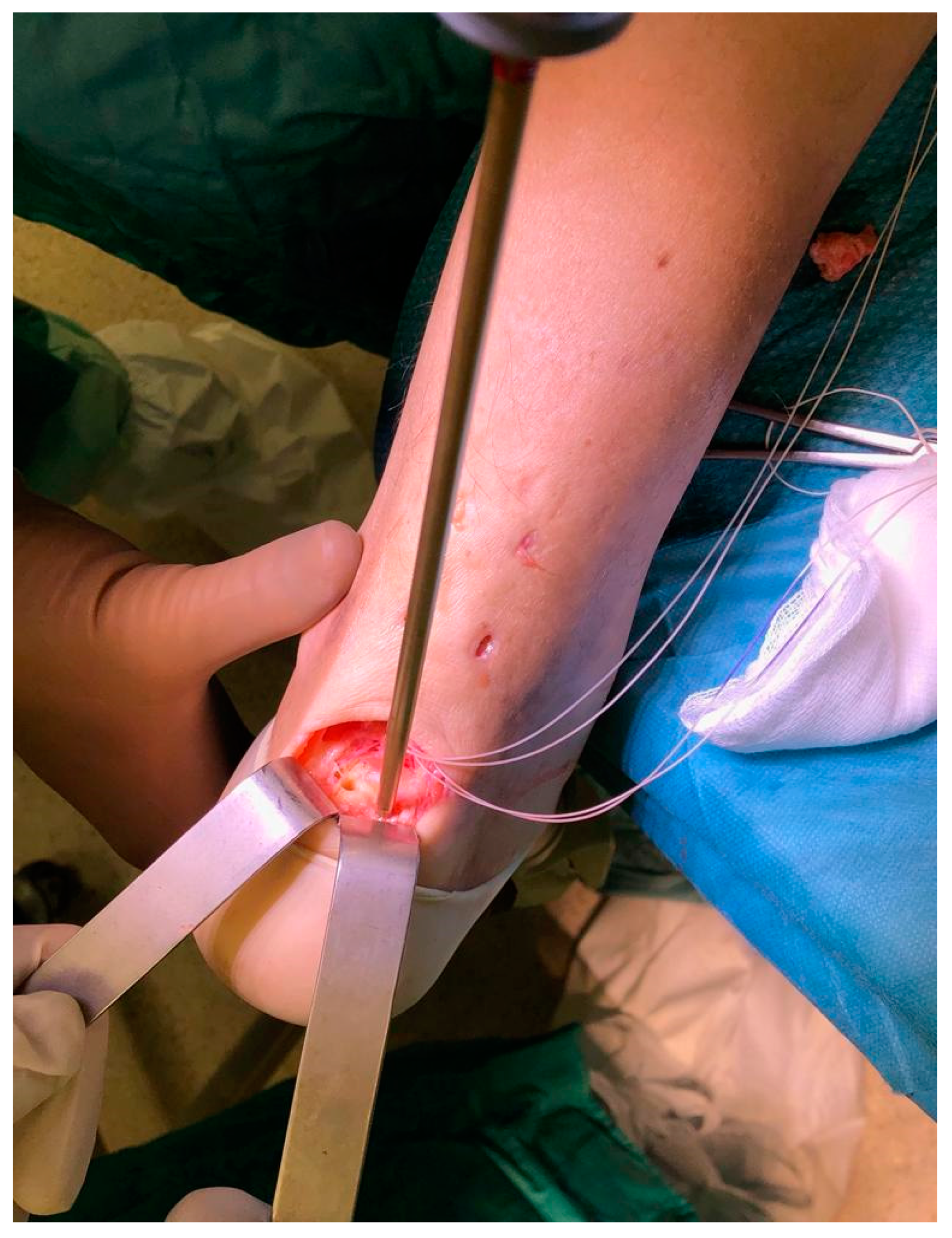 Medicina 56 00715 g003