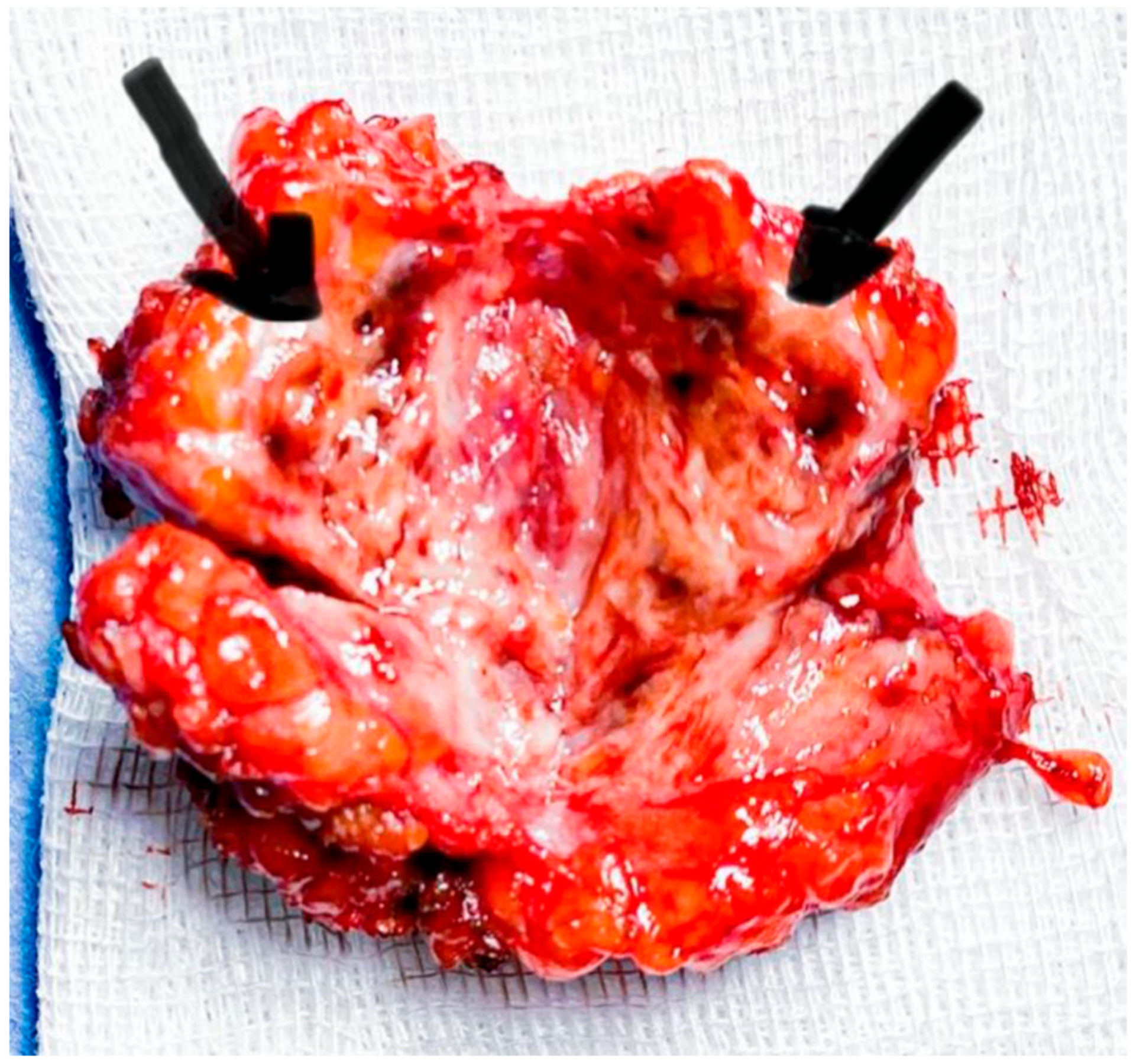 Medicina 56 00727 g004