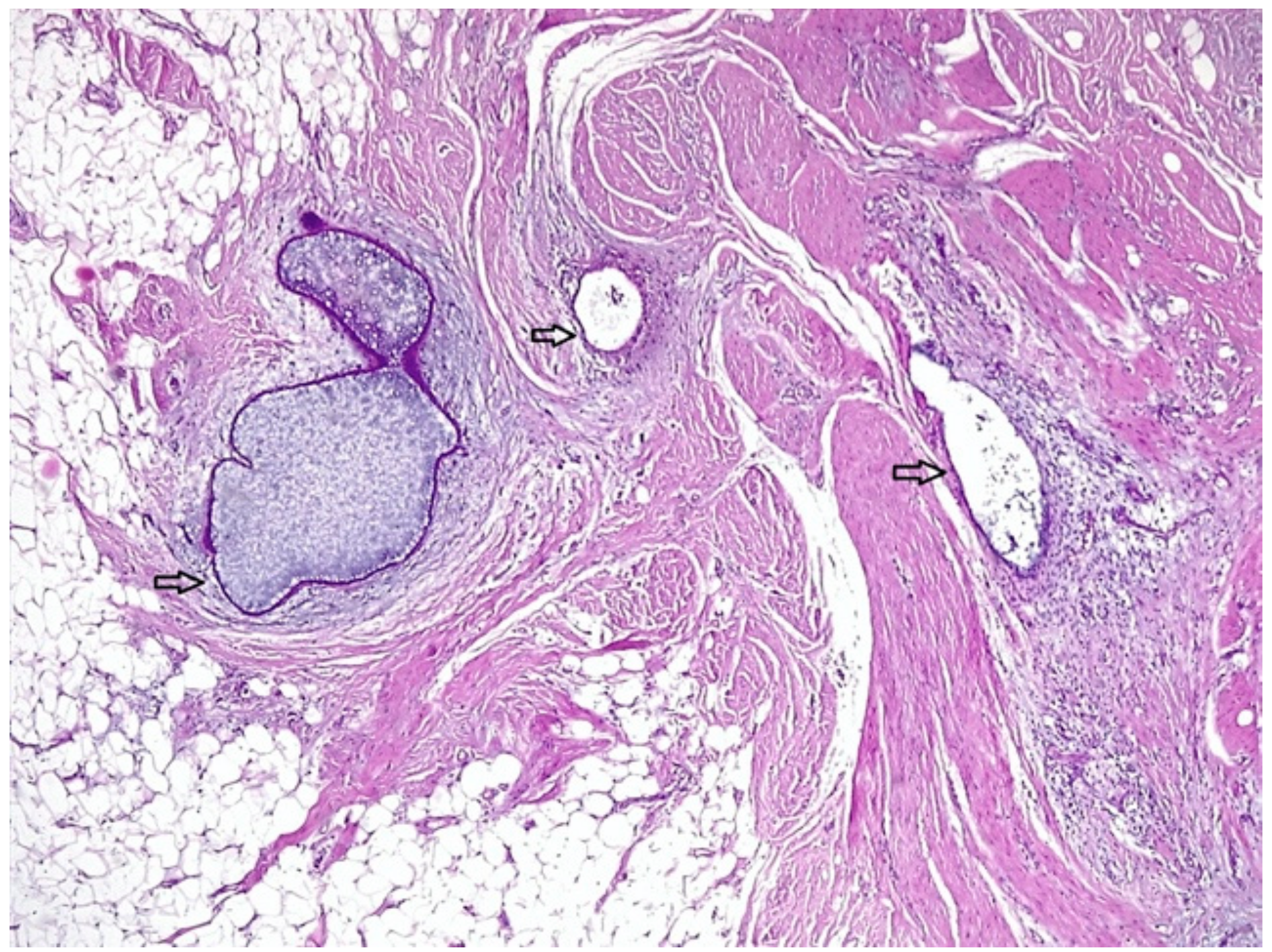 Medicina 56 00727 g005