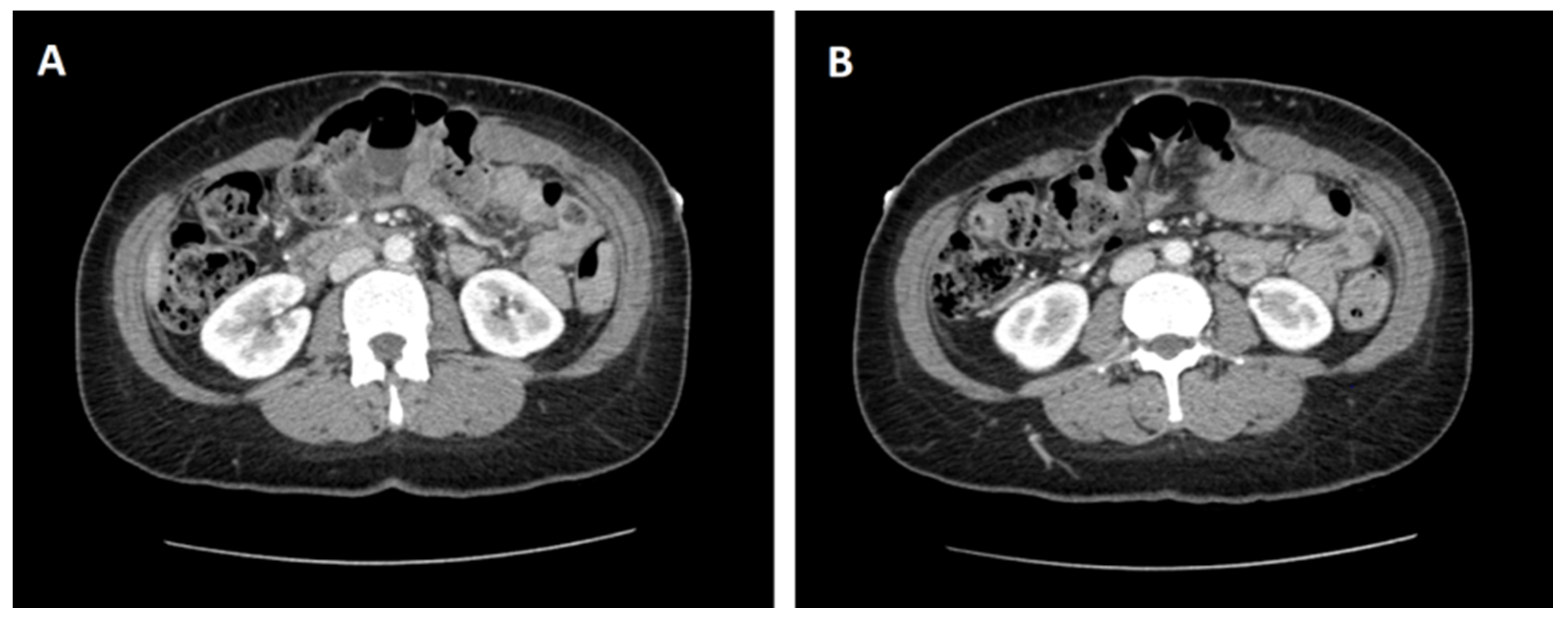 Medicina 57 00014 g001 Medicina 57 00014 g001