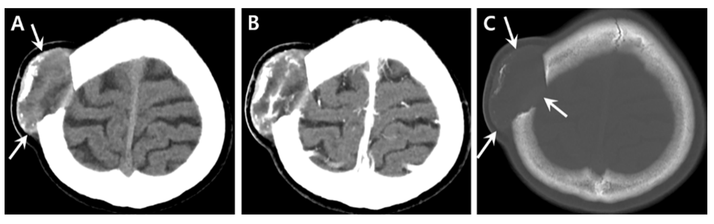 Medicina 57 00018 g002 Medicina 57 00018 g002