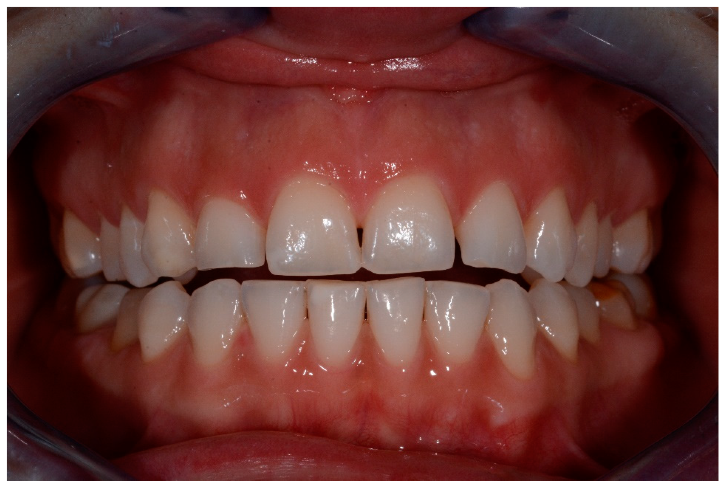 Medicina 57 00022 g004 Medicina 57 00022 g004