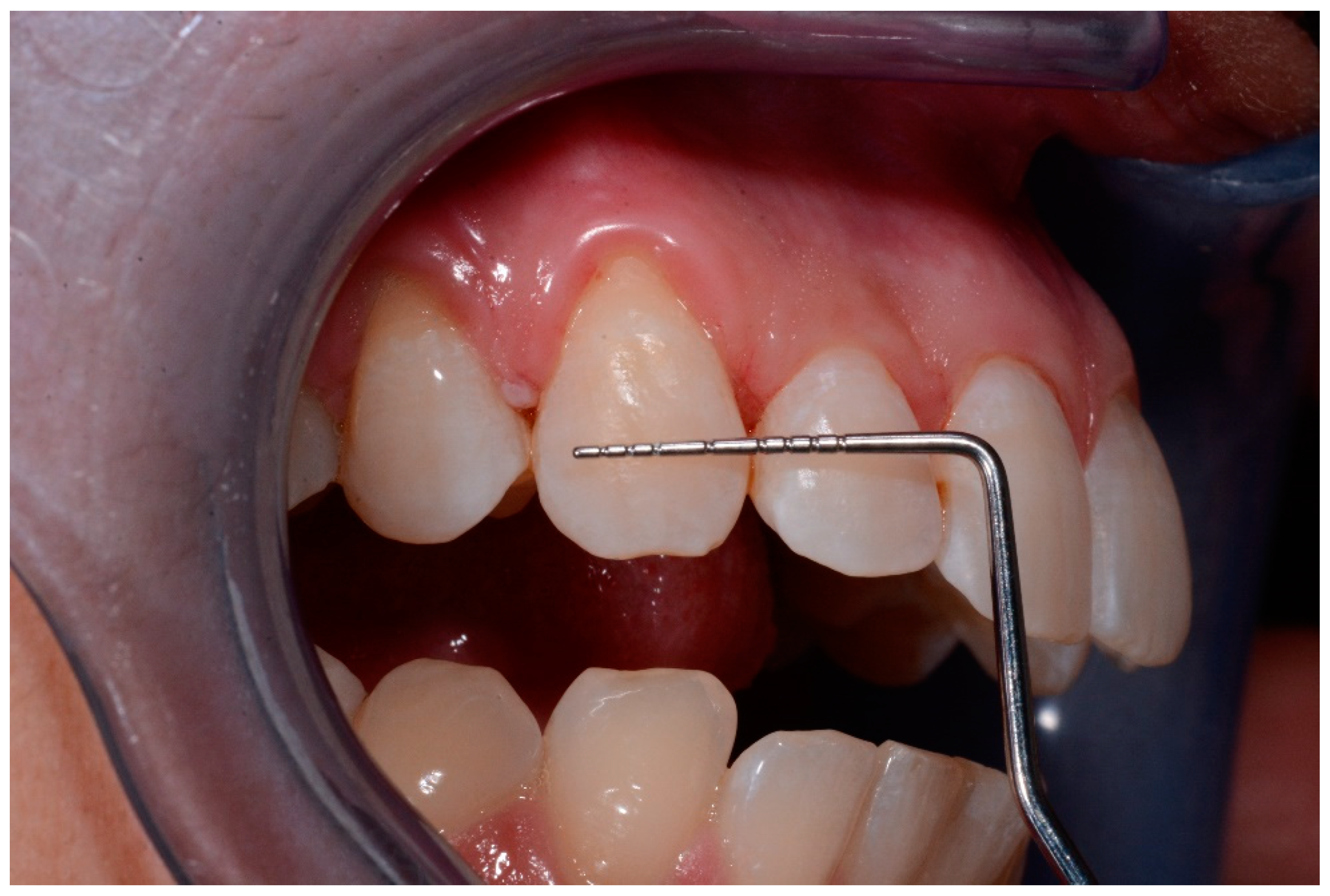 Medicina 57 00022 g005 Medicina 57 00022 g005