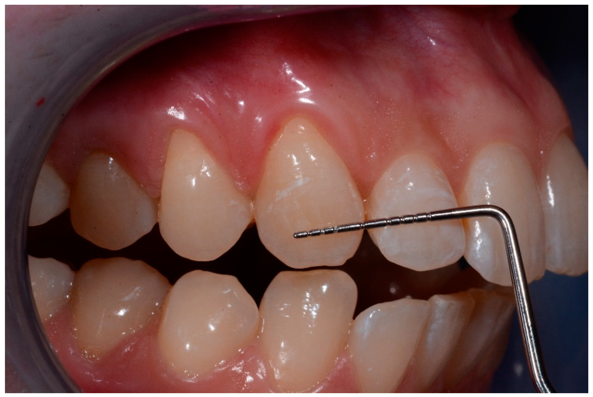 Medicina 57 00022 g007 Medicina 57 00022 g007