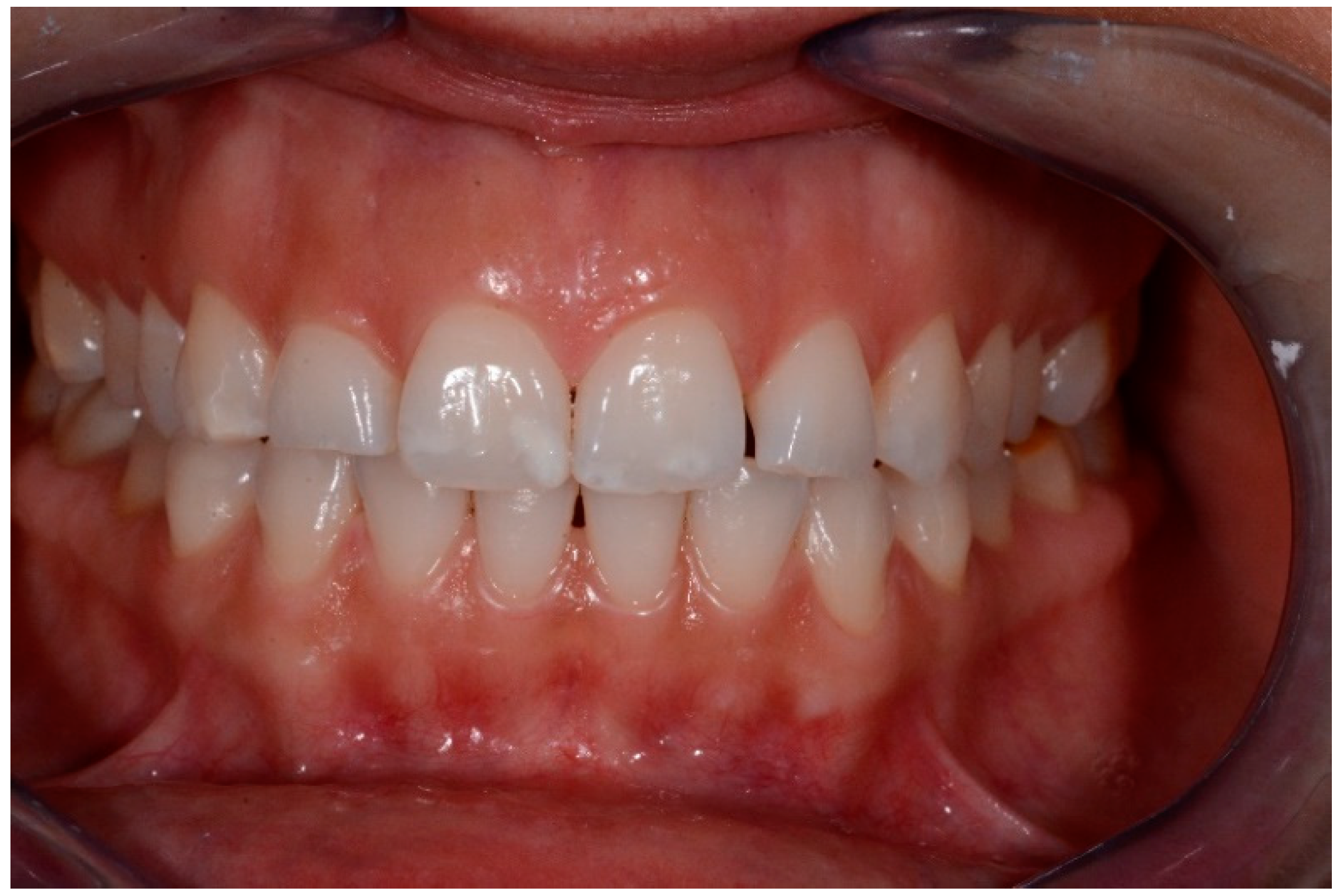 Medicina 57 00022 g008 Medicina 57 00022 g008