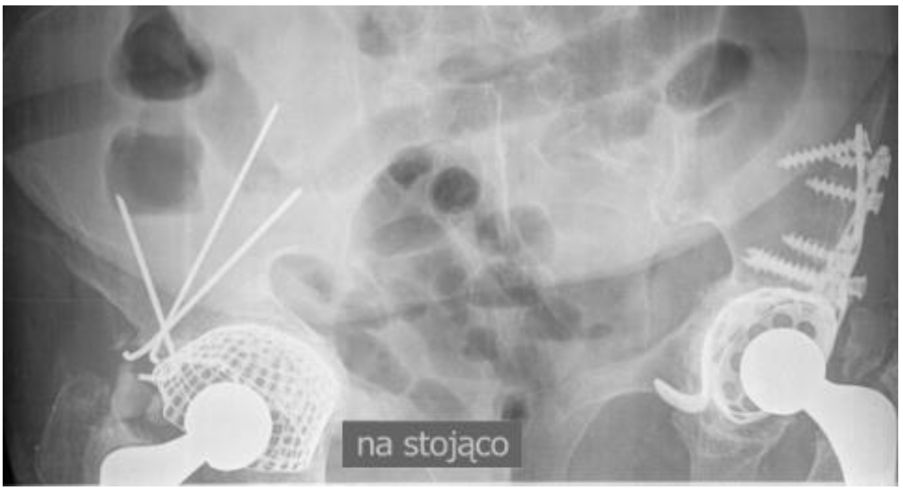 Medicina 57 00030 g004