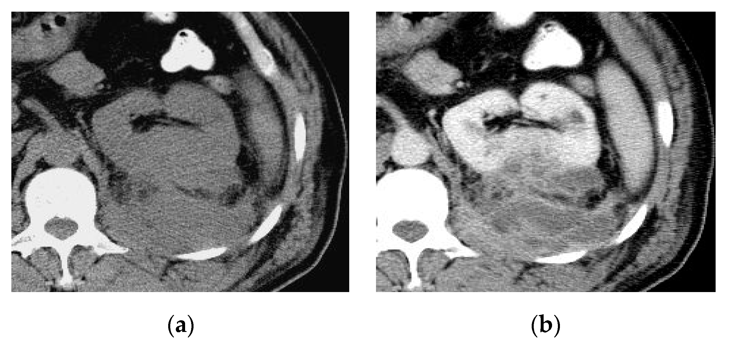 Medicina 57 00032 g004 Medicina 57 00032 g004