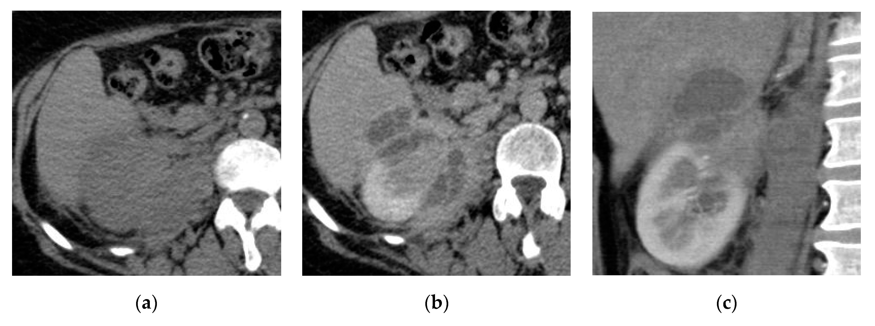 Medicina 57 00032 g006 Medicina 57 00032 g006
