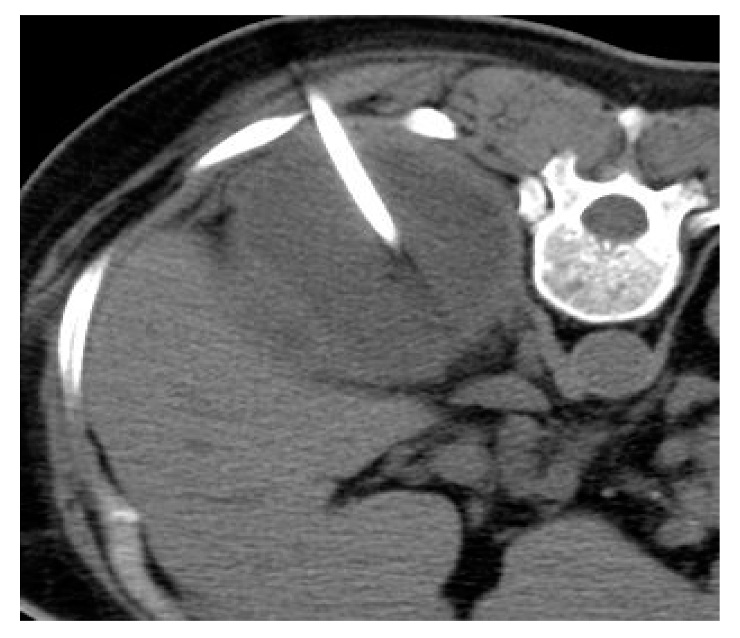 Medicina 57 00032 g007 Medicina 57 00032 g007
