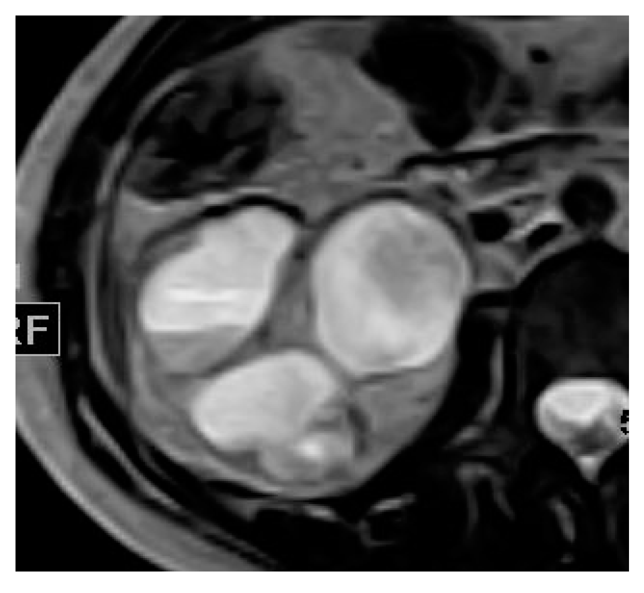 Medicina 57 00032 g010 Medicina 57 00032 g010