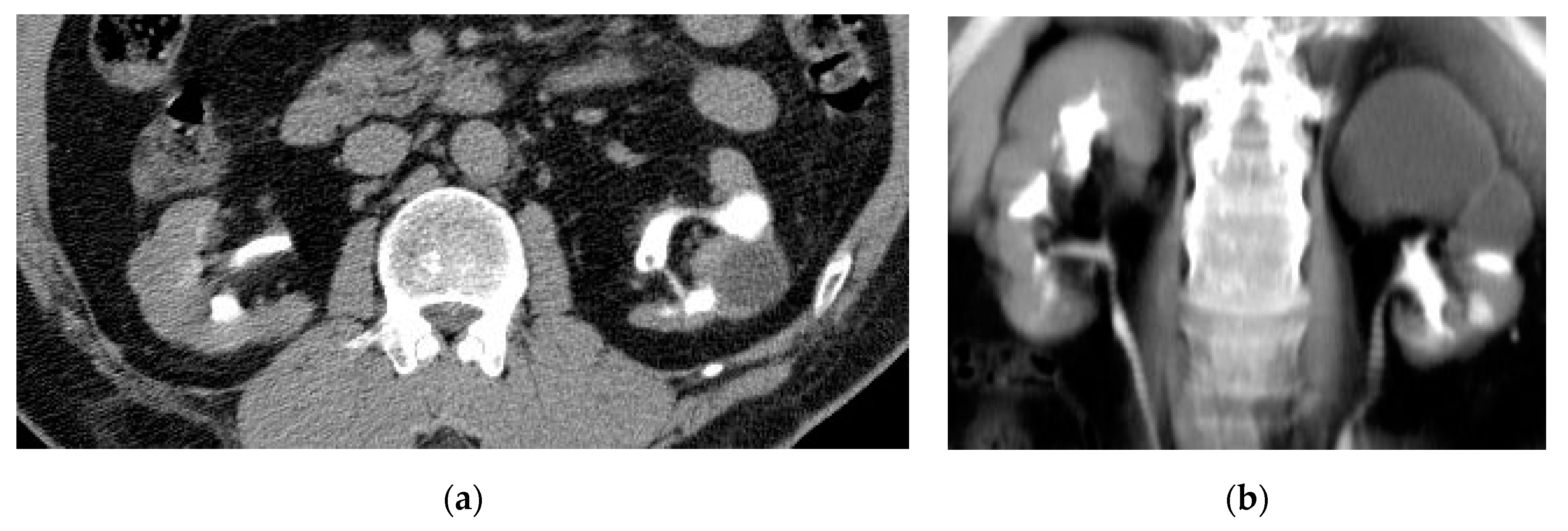 Medicina 57 00032 g011 Medicina 57 00032 g011