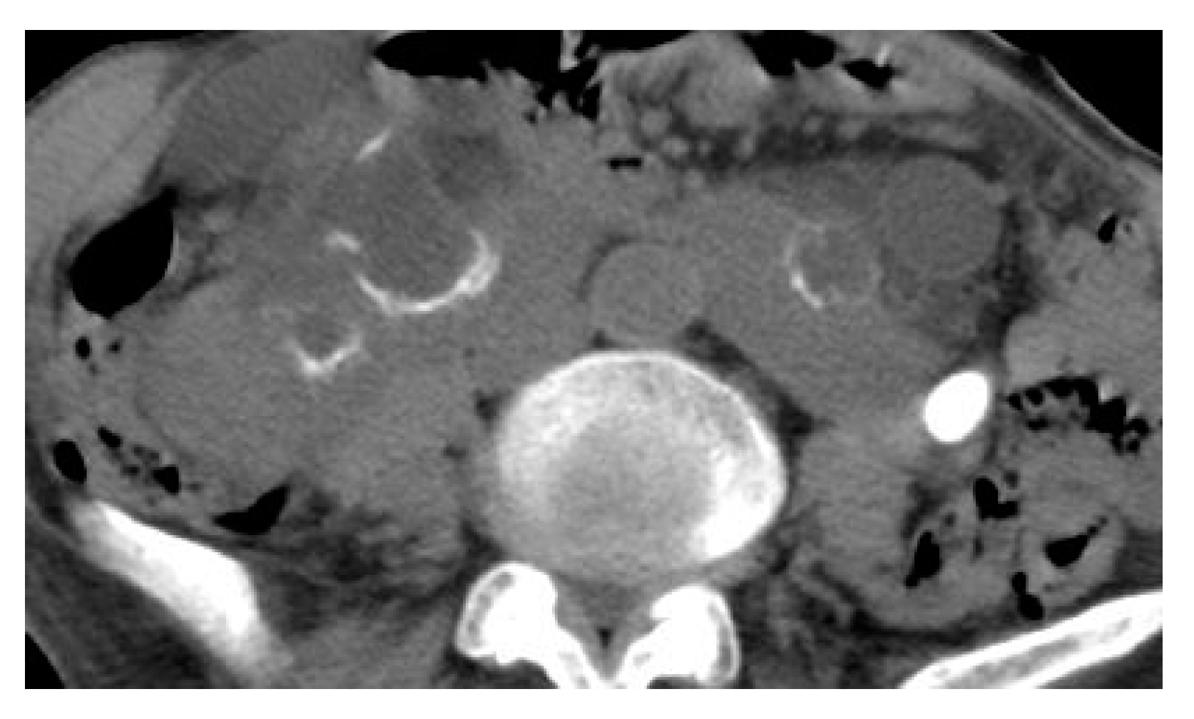 Medicina 57 00032 g019 Medicina 57 00032 g019