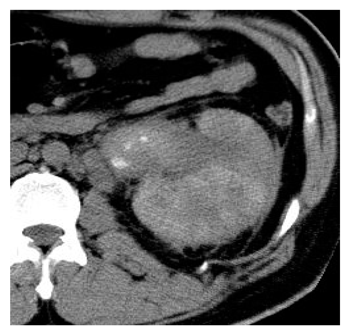 Medicina 57 00032 g020 Medicina 57 00032 g020