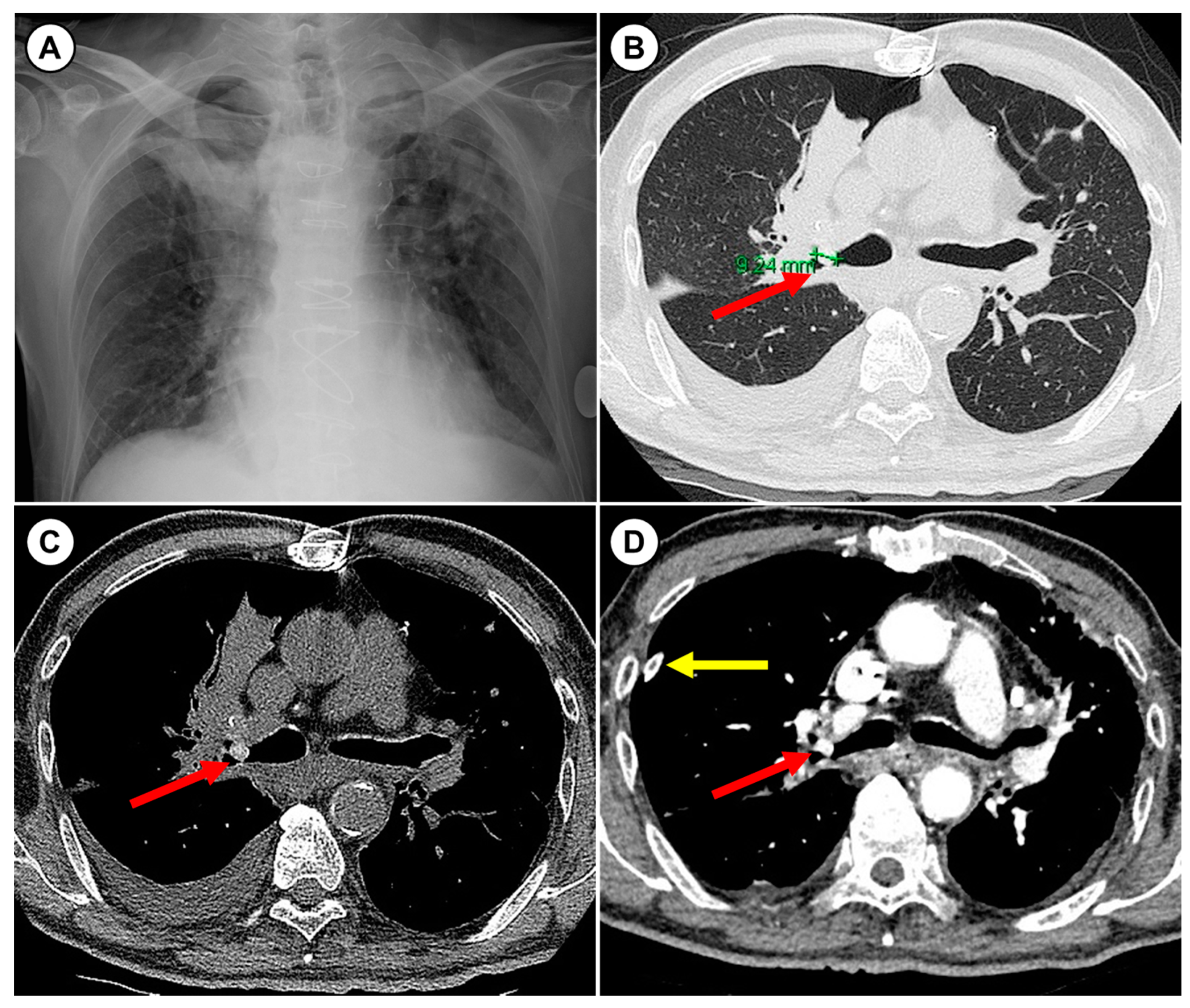 Medicina 57 00050 g001