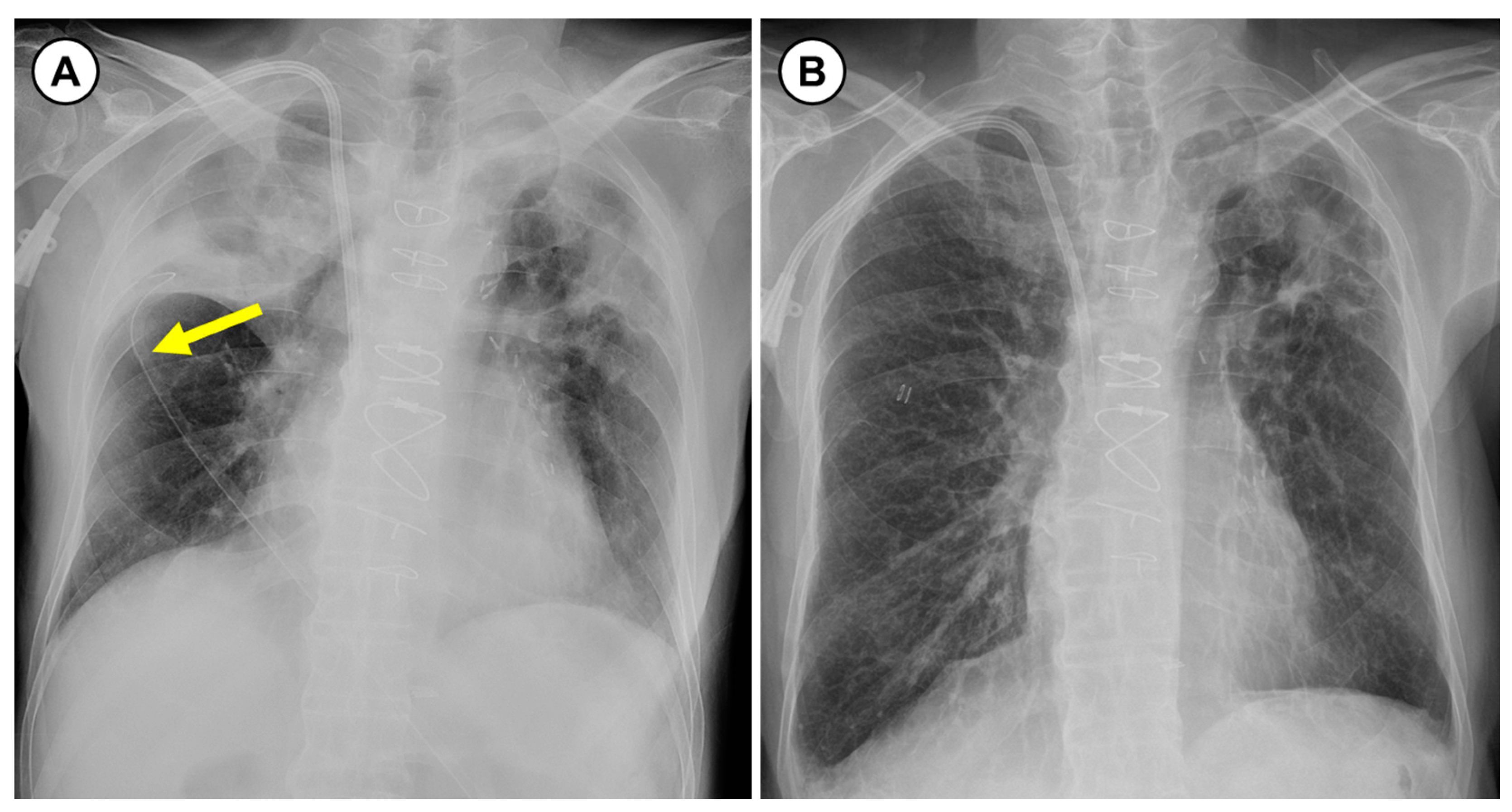Medicina 57 00050 g003