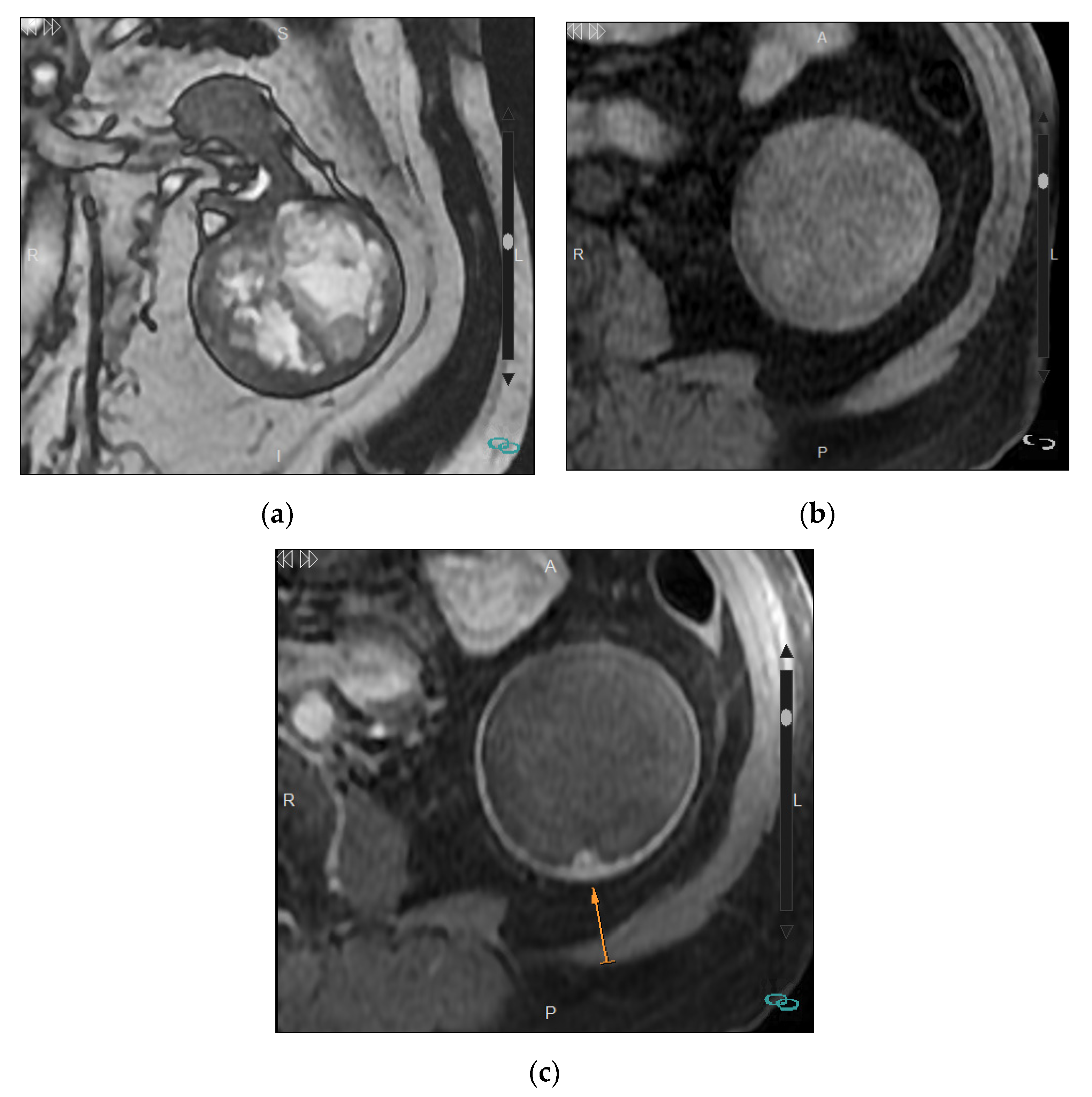 Medicina 57 00051 g003 Medicina 57 00051 g003