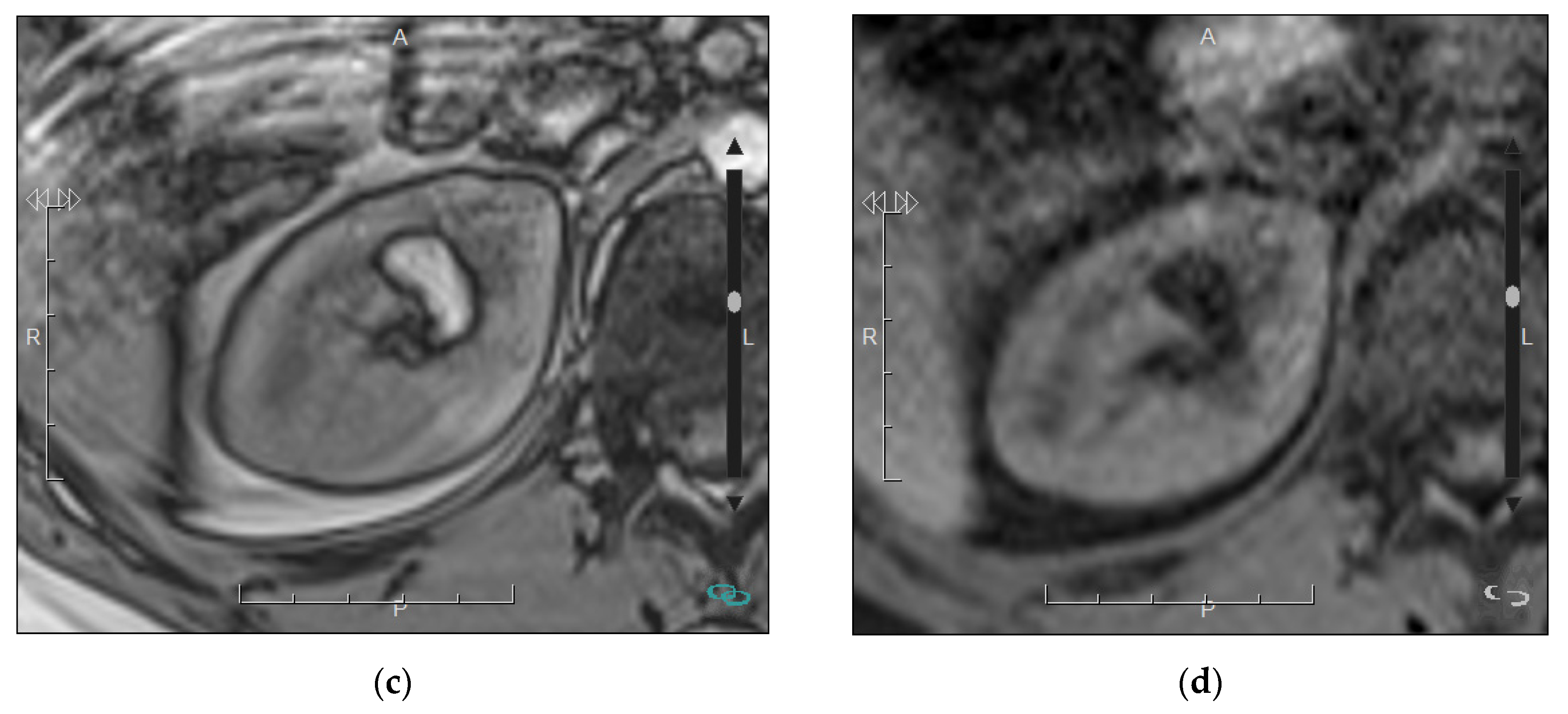 Medicina 57 00051 g006b Medicina 57 00051 g006b