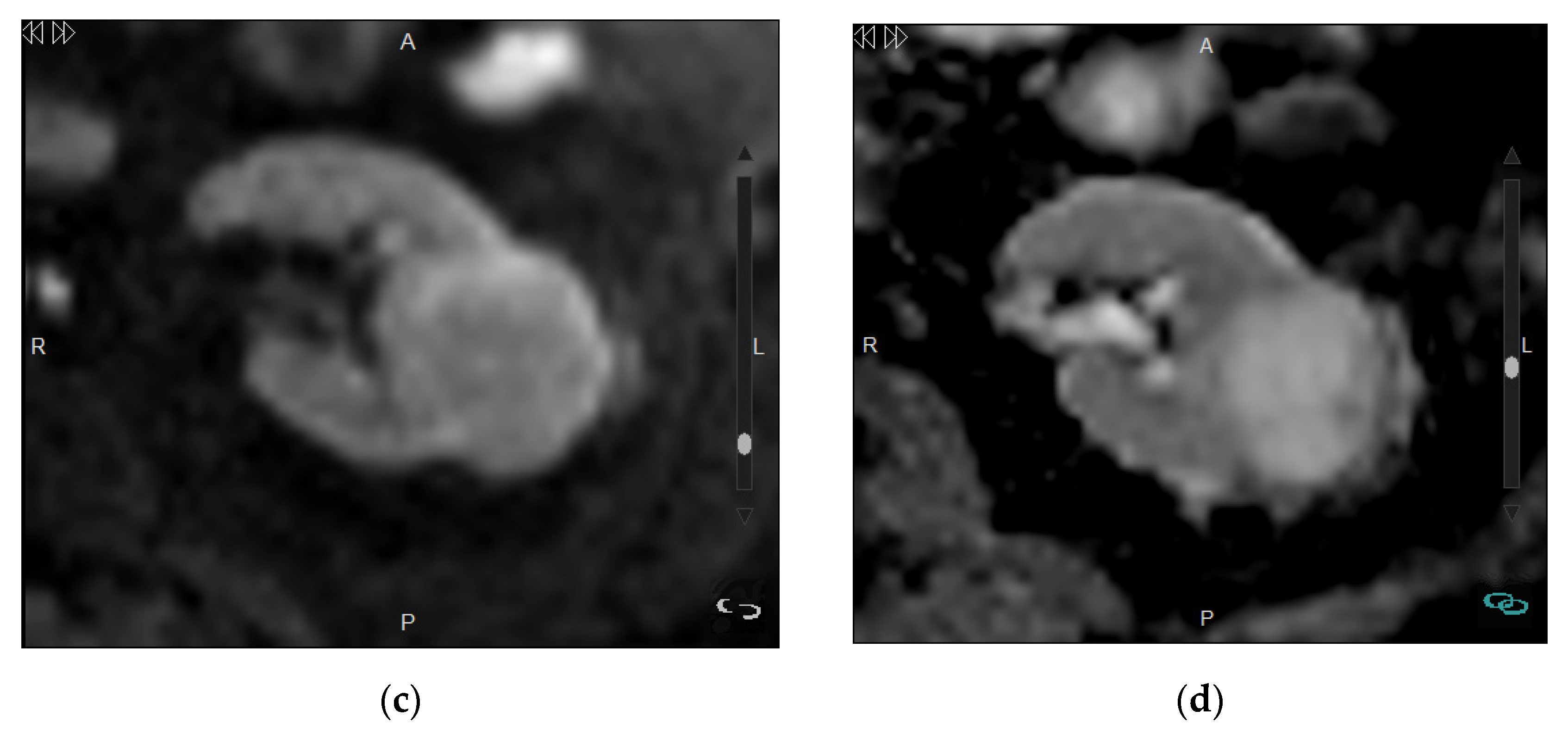 Medicina 57 00051 g007b Medicina 57 00051 g007b