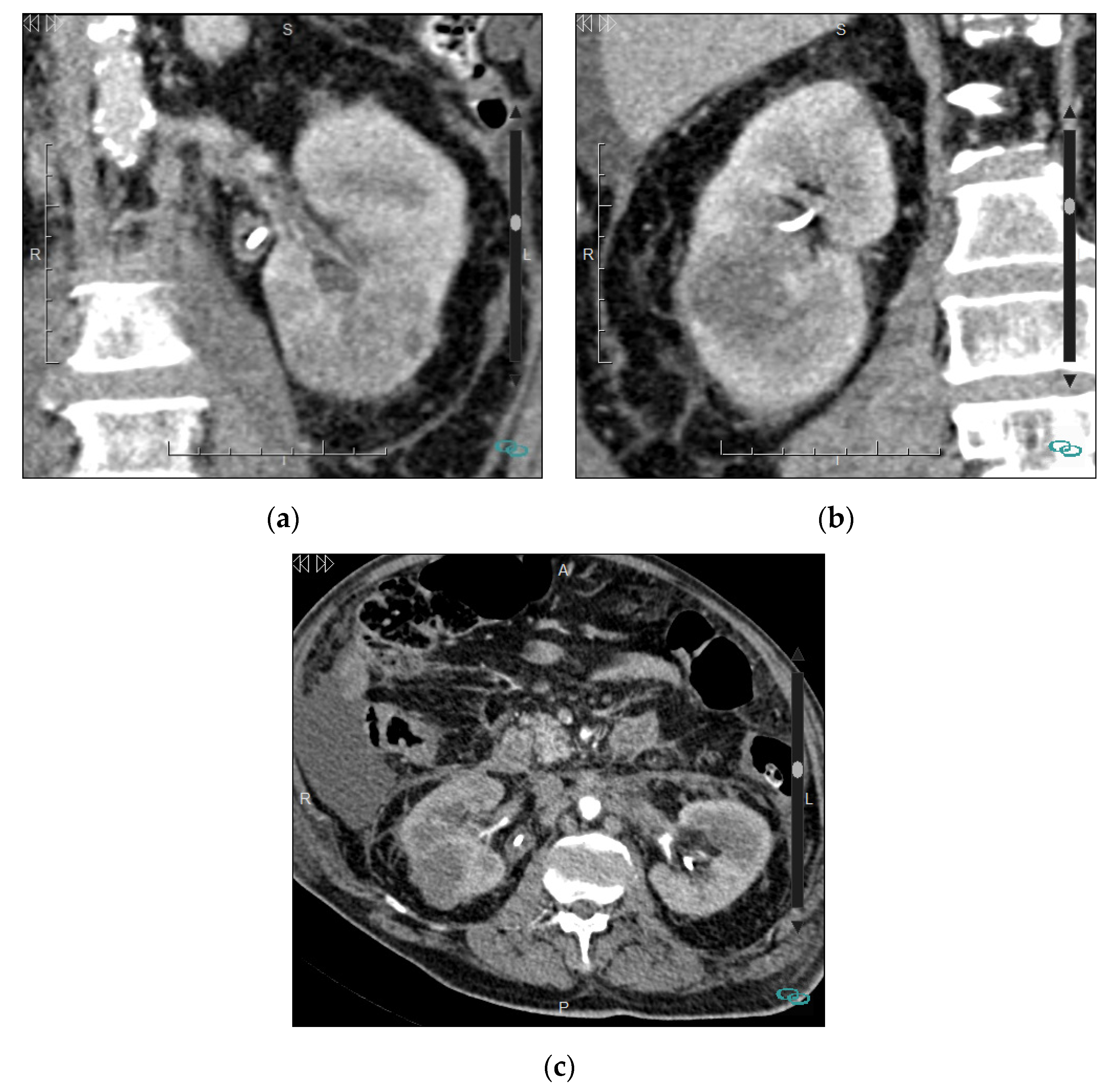 Medicina 57 00051 g010 Medicina 57 00051 g010