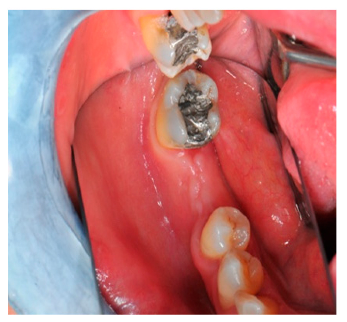 Medicina 57 00060 g002