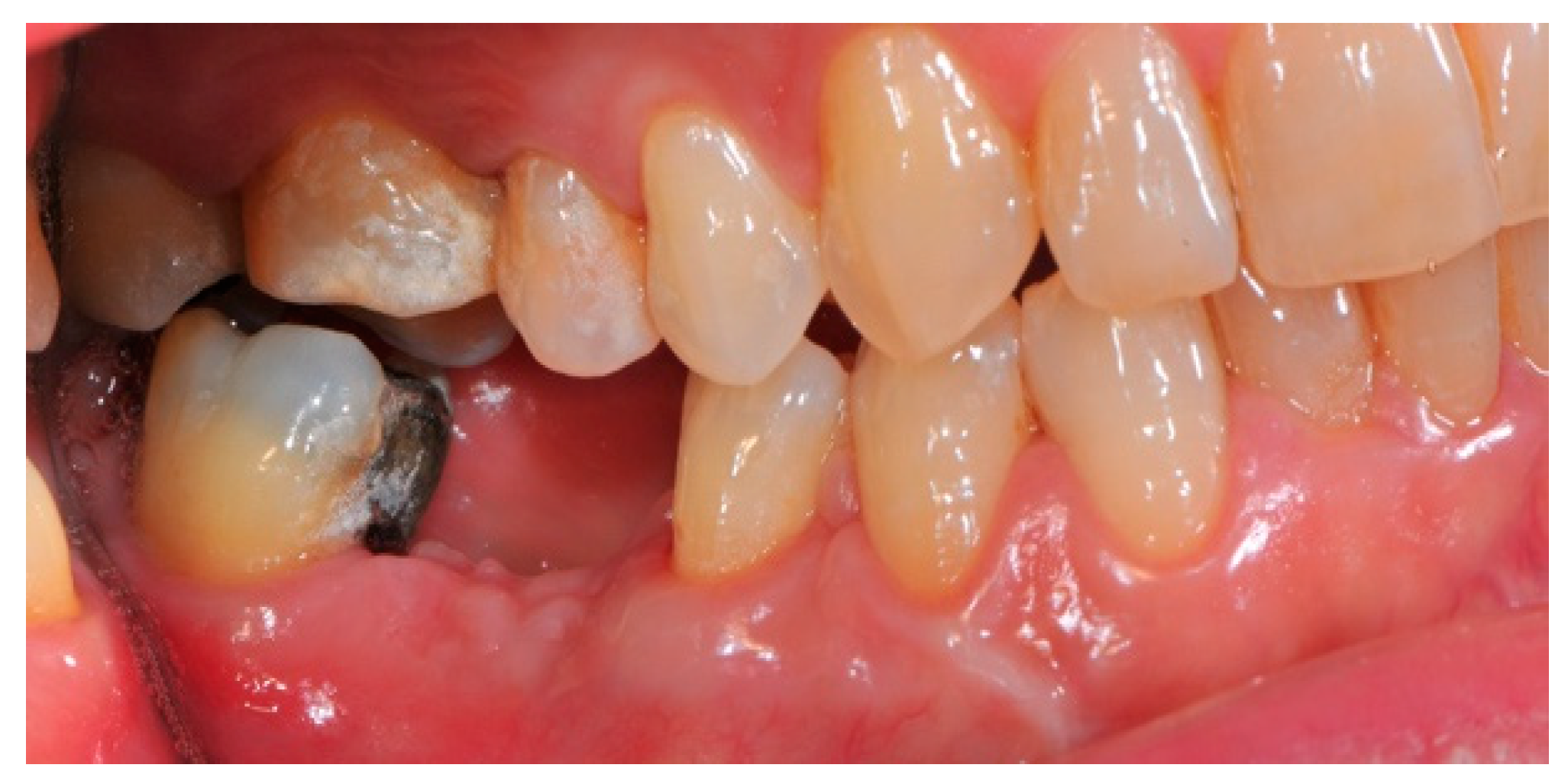 Medicina 57 00060 g003